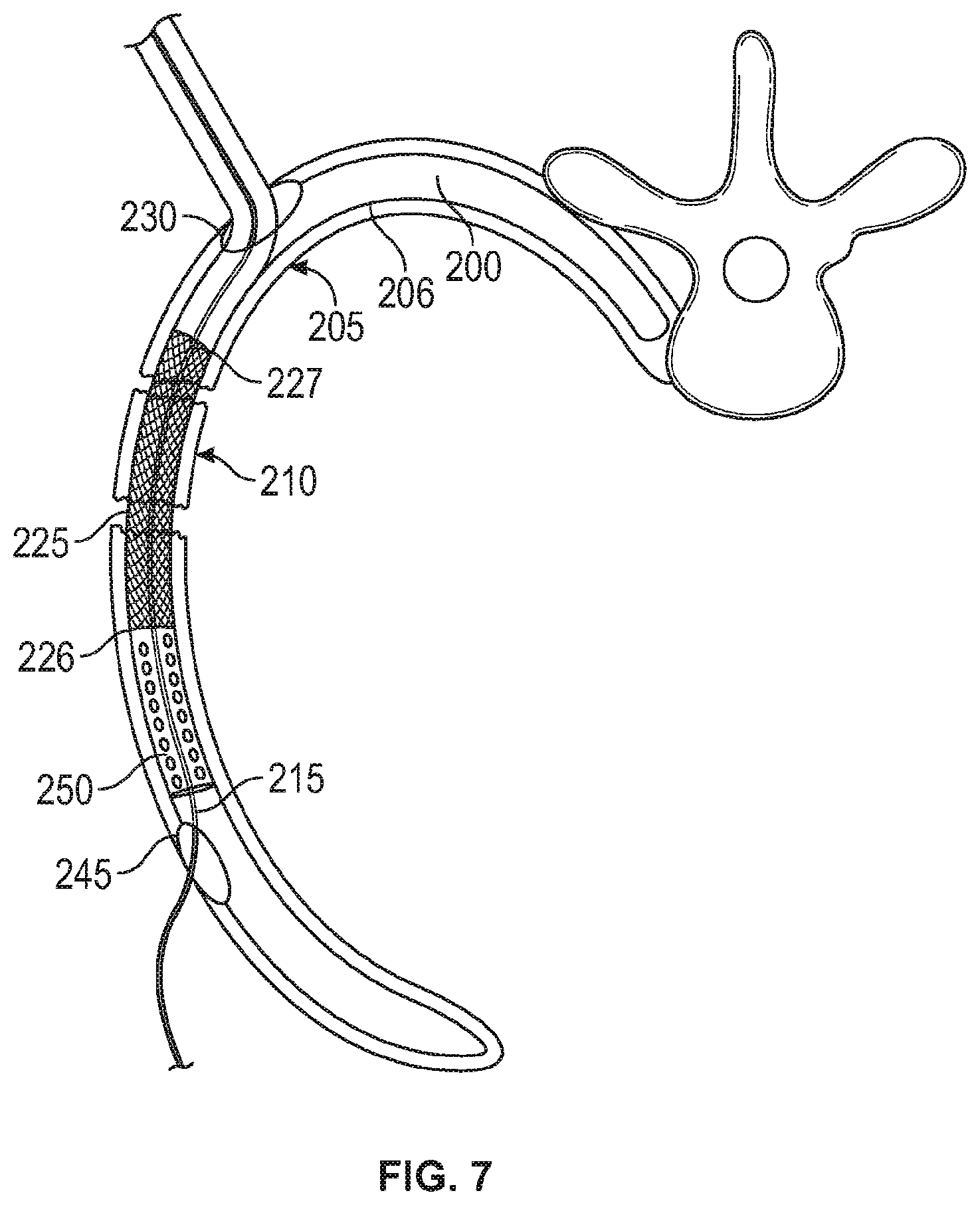 Patent US12137949 Figure 4 – Rib fracture fixation device and methods for use thereof