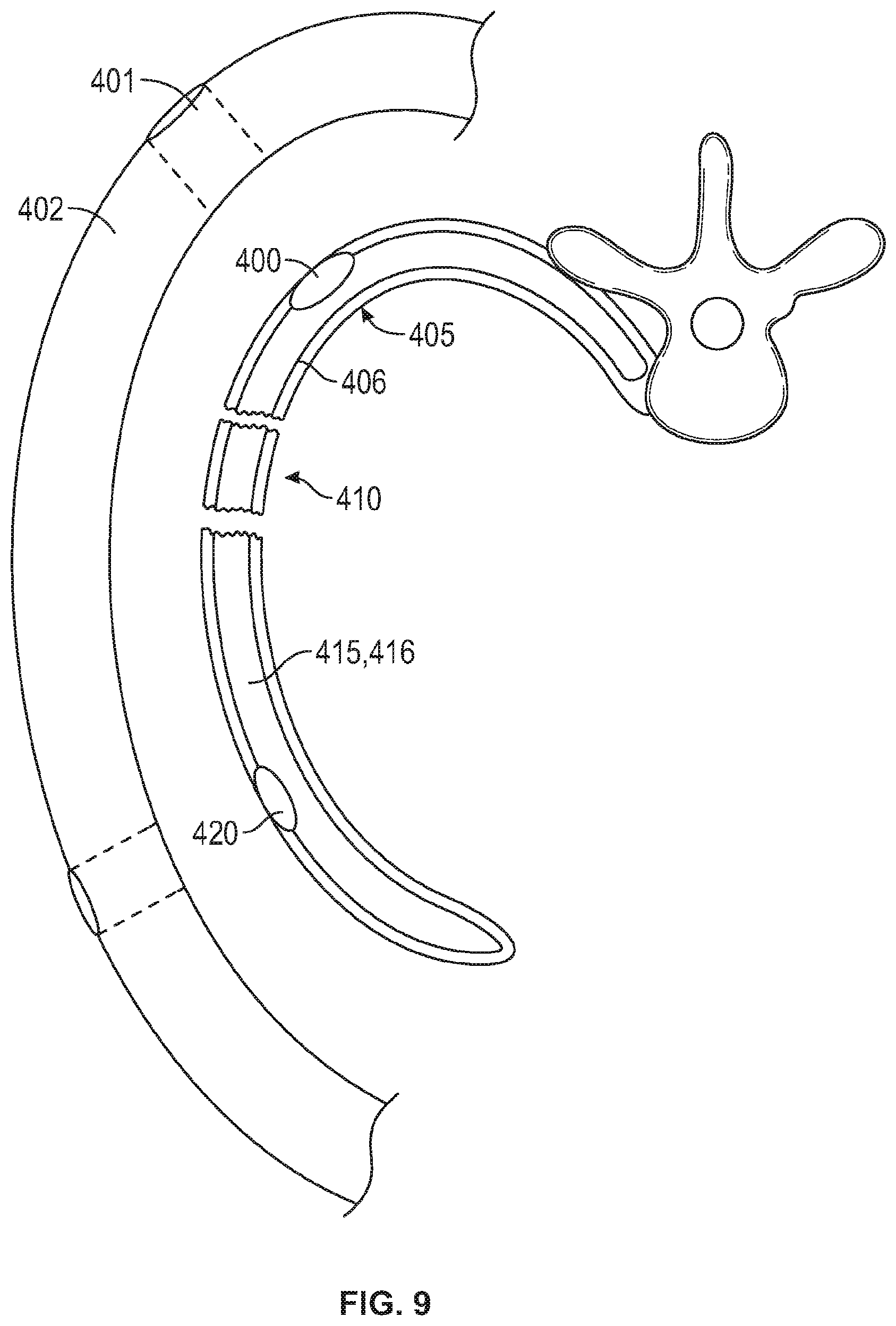 Patent US12137949 Figure 6 – Rib fracture fixation device and methods for use thereof