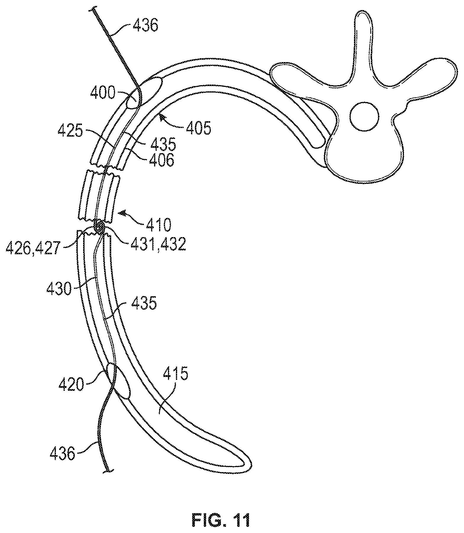 Patent US12137949 Figure 8 – Rib fracture fixation device and methods for use thereof