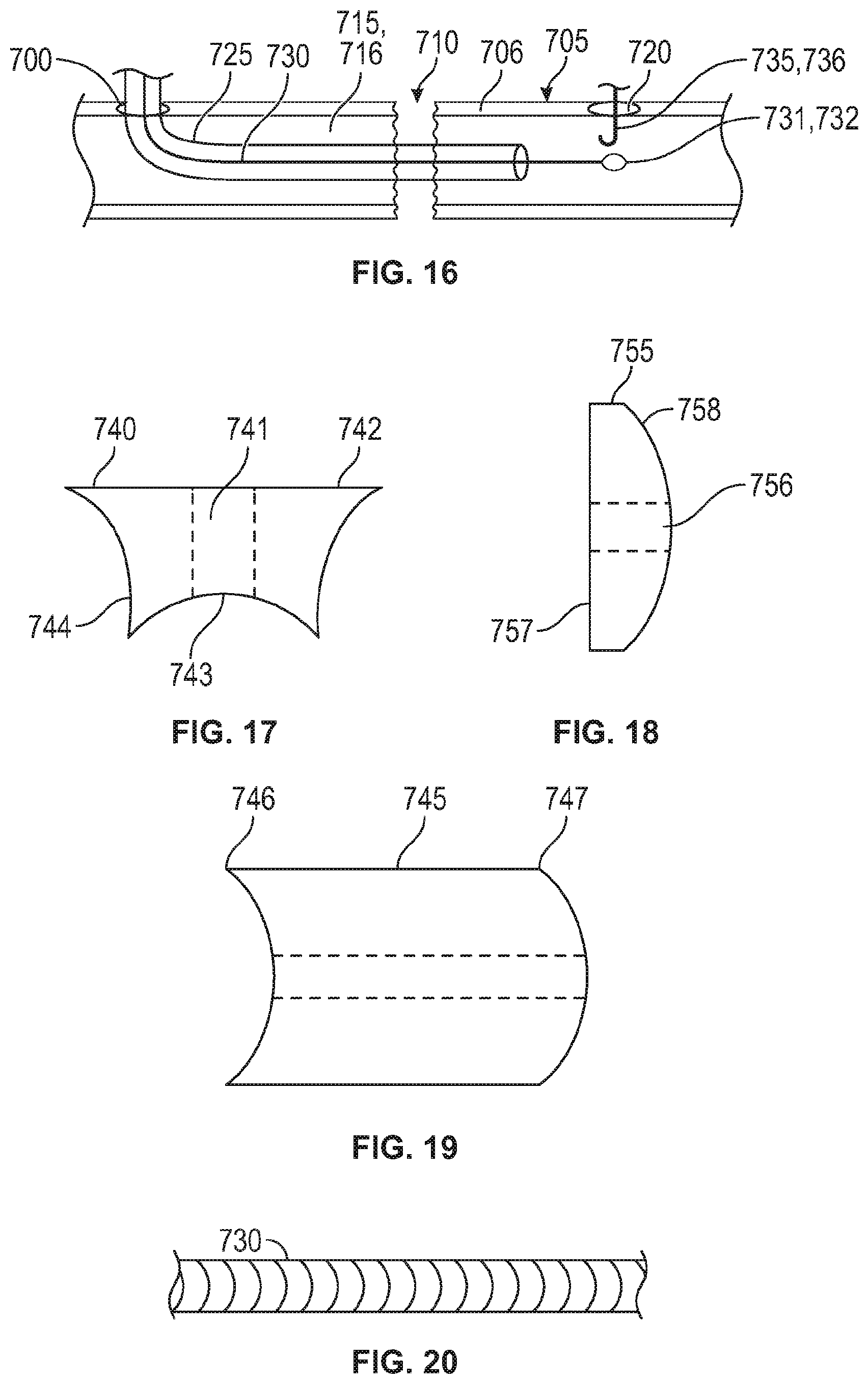 Patent US12137949 Figure 12 – Rib fracture fixation device and methods for use thereof
