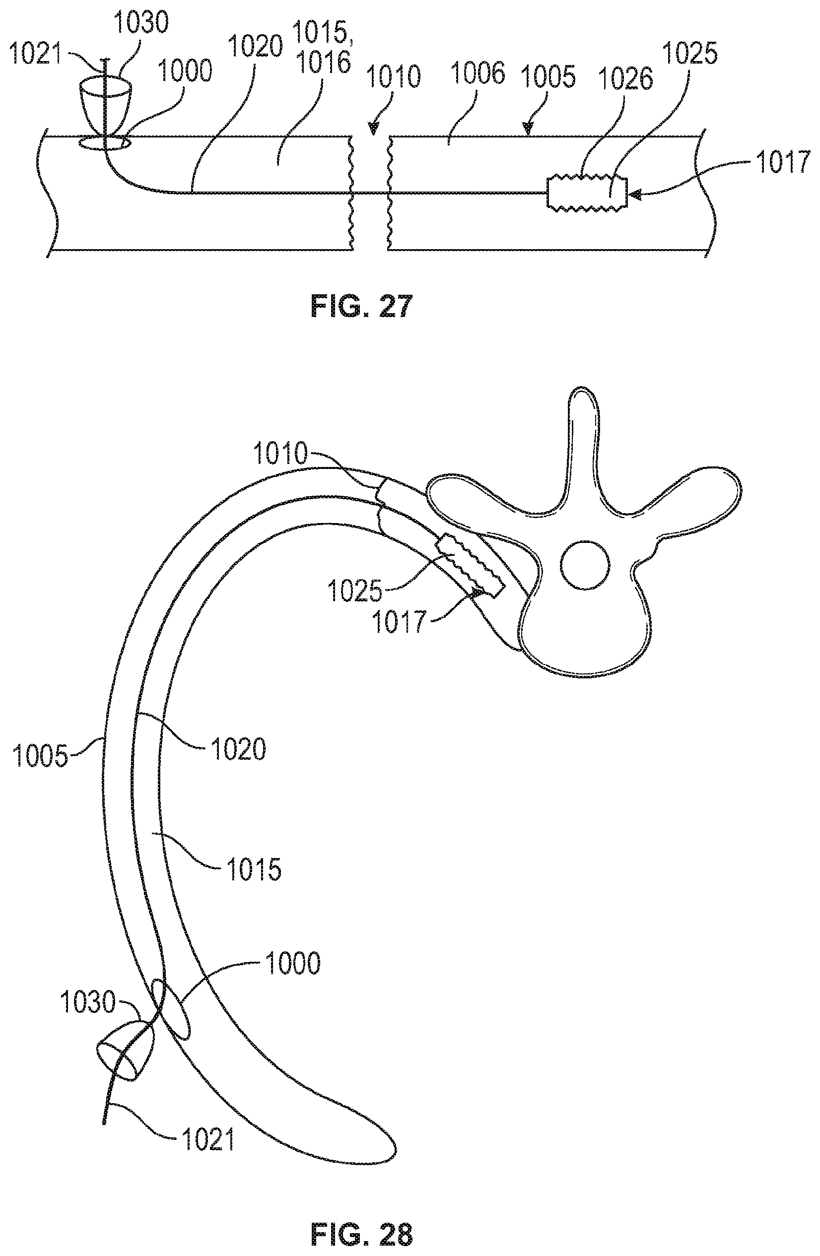 Patent US12137949 Figure 17 – Rib fracture fixation device and methods for use thereof