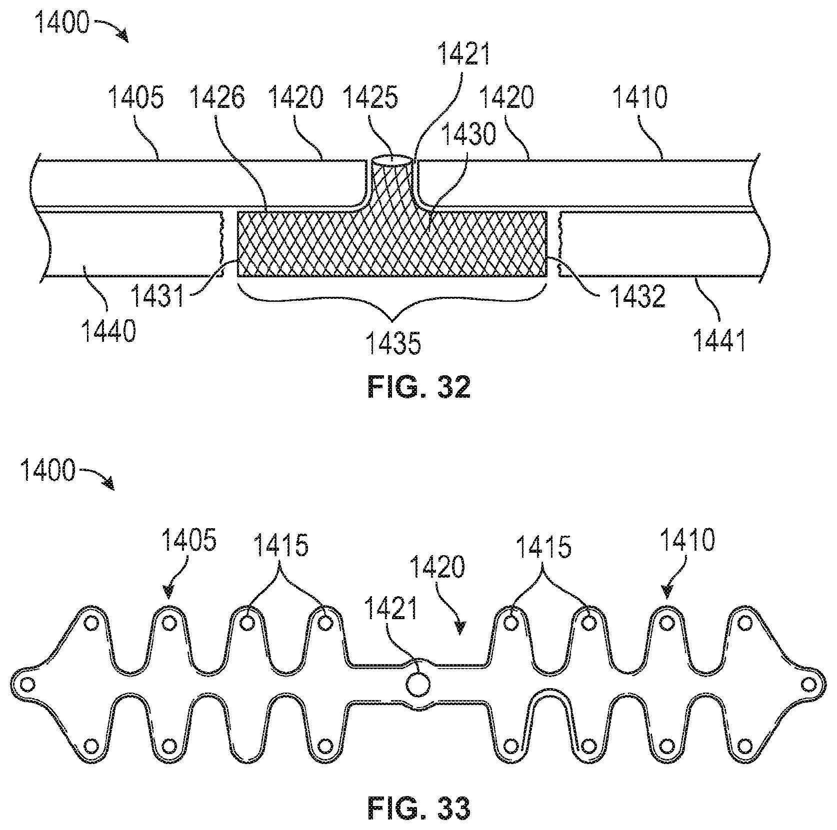 Patent US12137949 Figure 19 – Rib fracture fixation device and methods for use thereof