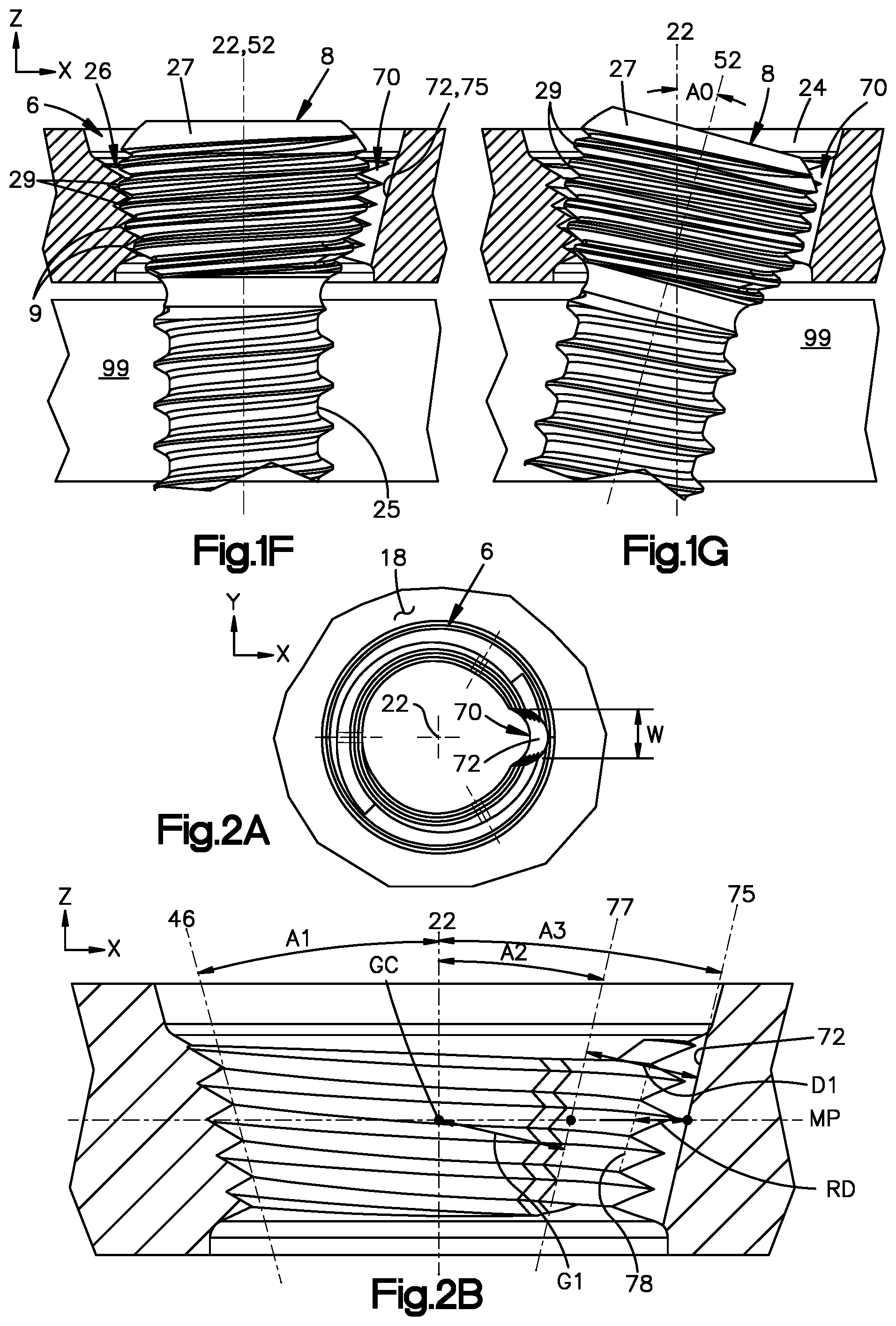 Patent US12137951 Figure 3 – Bone plates having polygonal locking holes with thread interruption, and related systems and methods