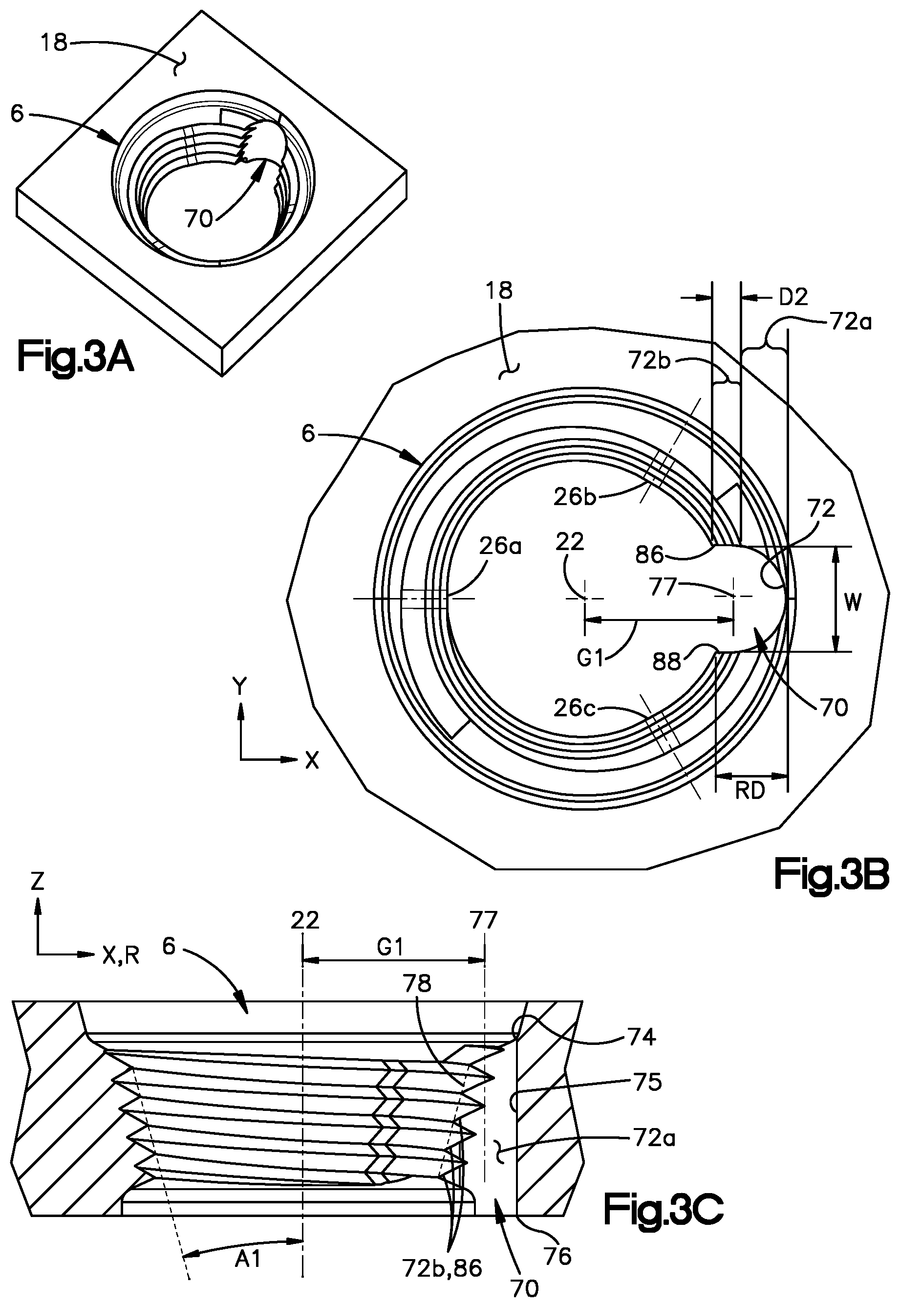 Patent US12137951 Figure 4 – Bone plates having polygonal locking holes with thread interruption, and related systems and methods