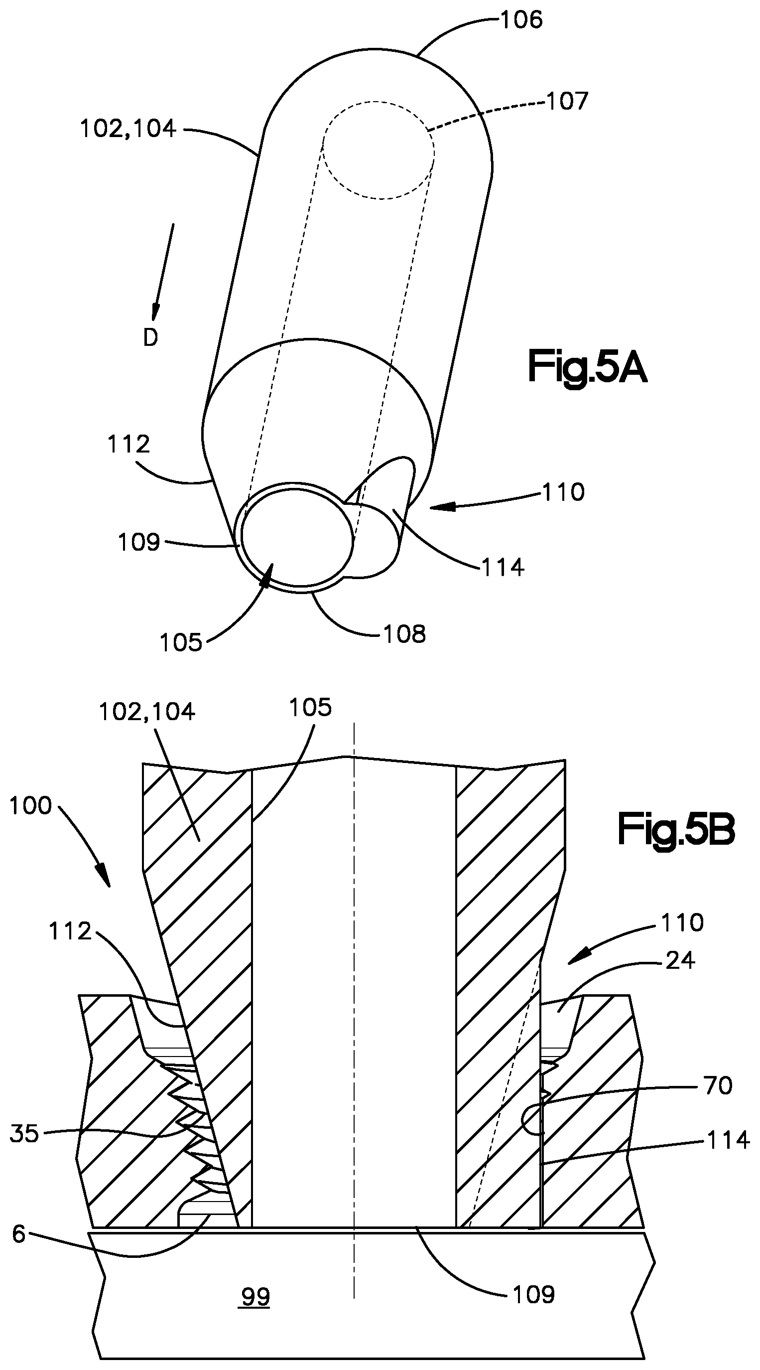 Patent US12137951 Figure 6 – Bone plates having polygonal locking holes with thread interruption, and related systems and methods