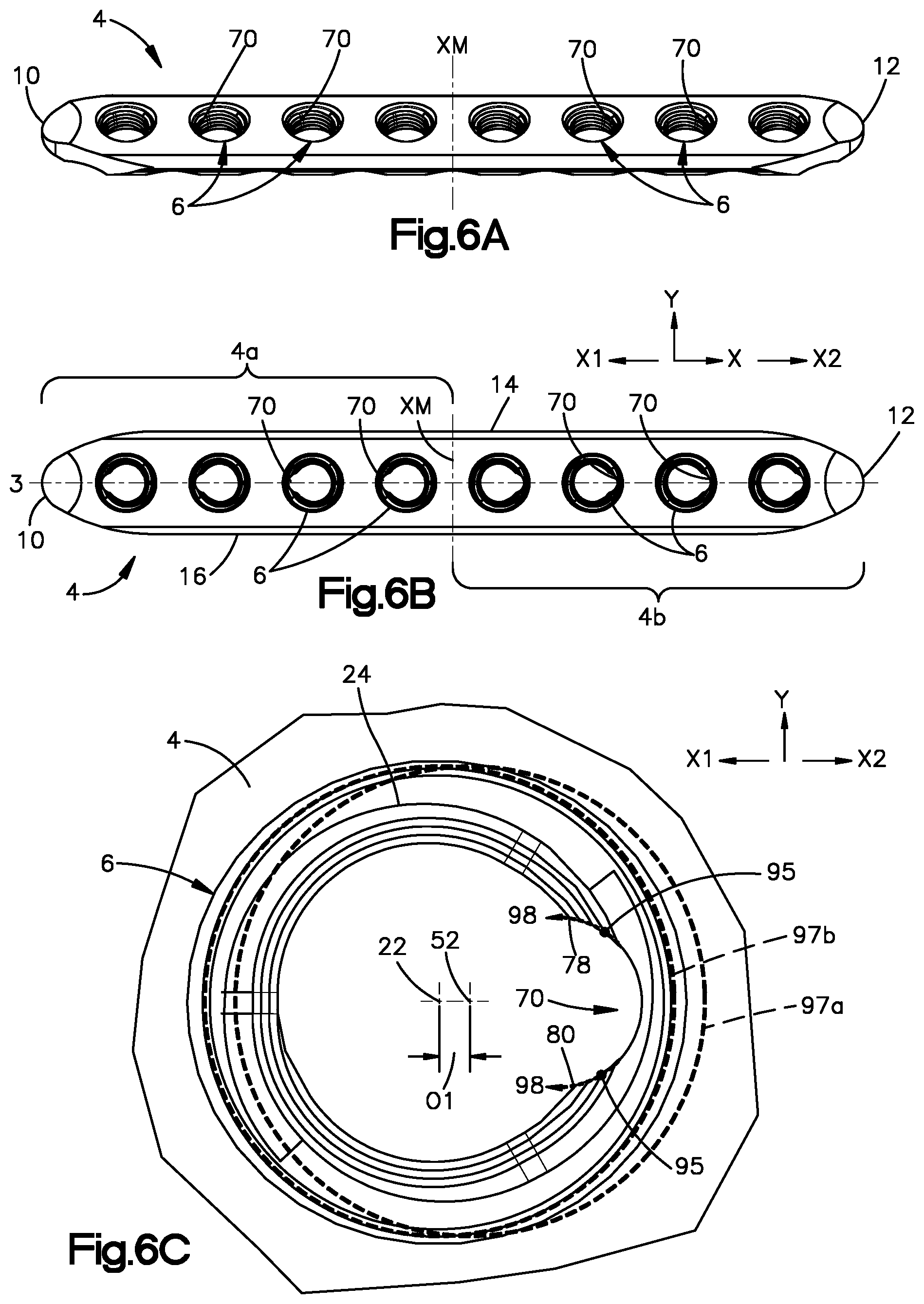Patent US12137951 Figure 7 – Bone plates having polygonal locking holes with thread interruption, and related systems and methods