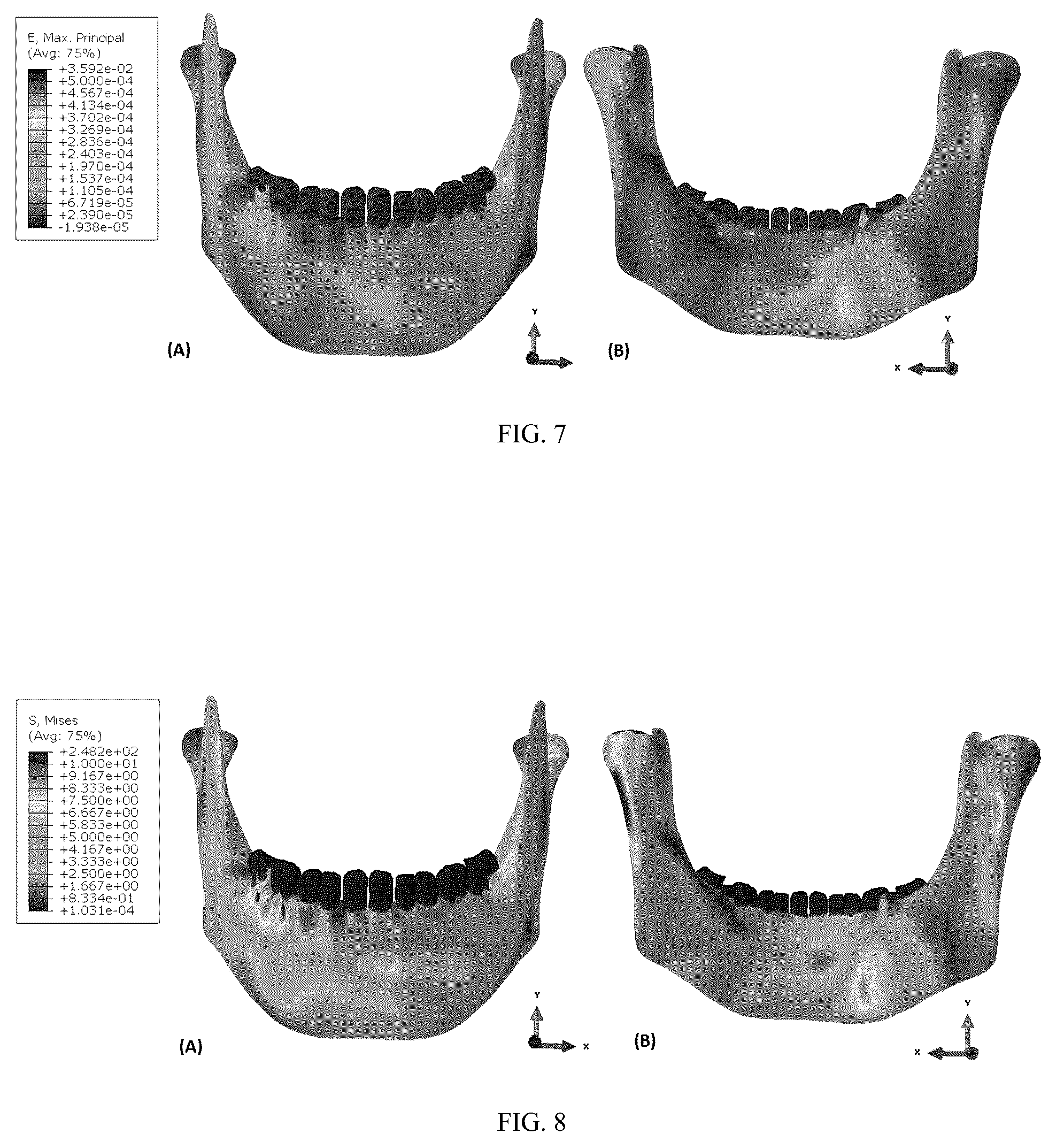 Patent US12137952 Figure 5 – Methods, devices, and manufacture of the devices for musculoskeletal reconstructive surgery
