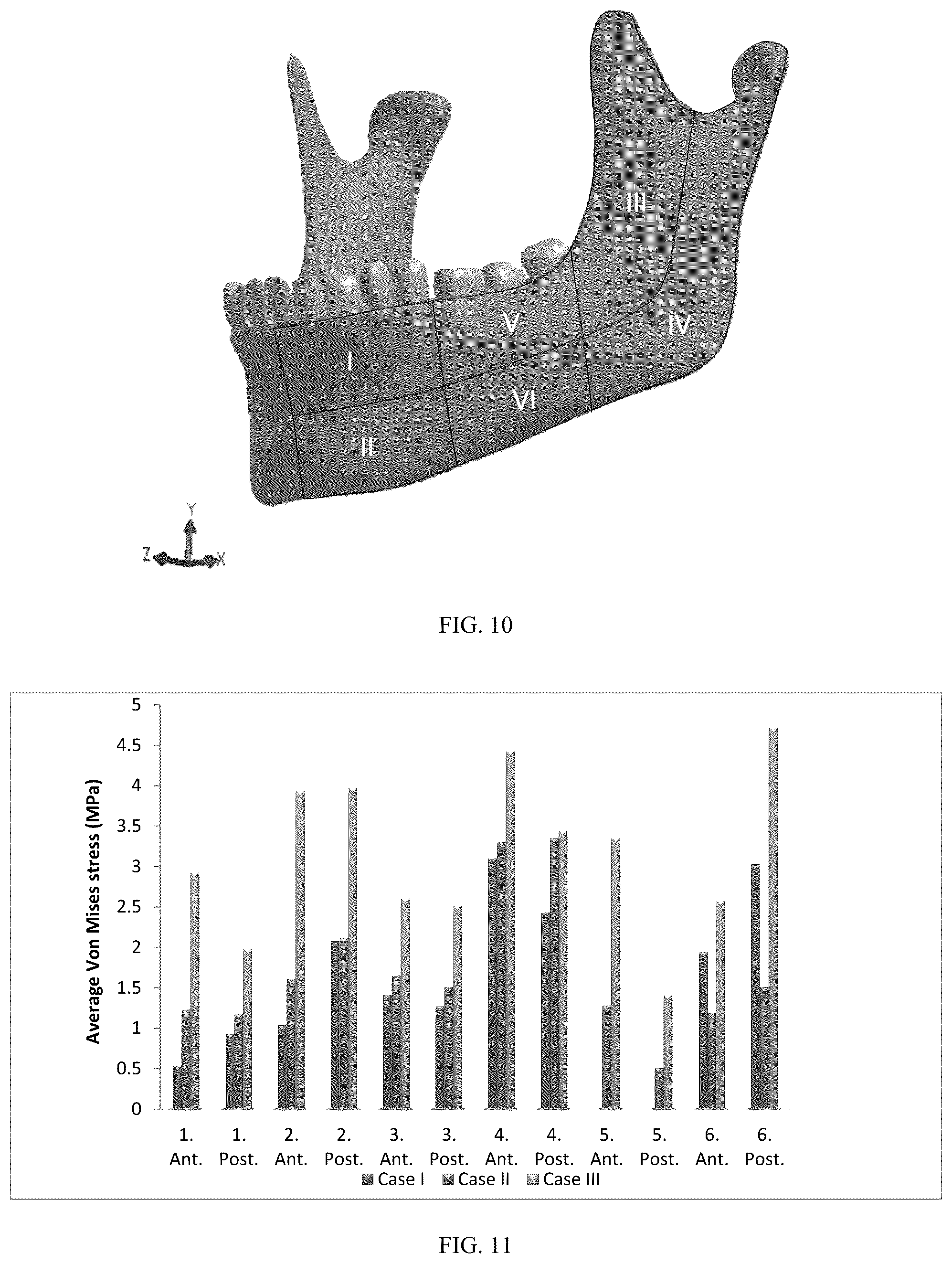 Patent US12137952 Figure 7 – Methods, devices, and manufacture of the devices for musculoskeletal reconstructive surgery