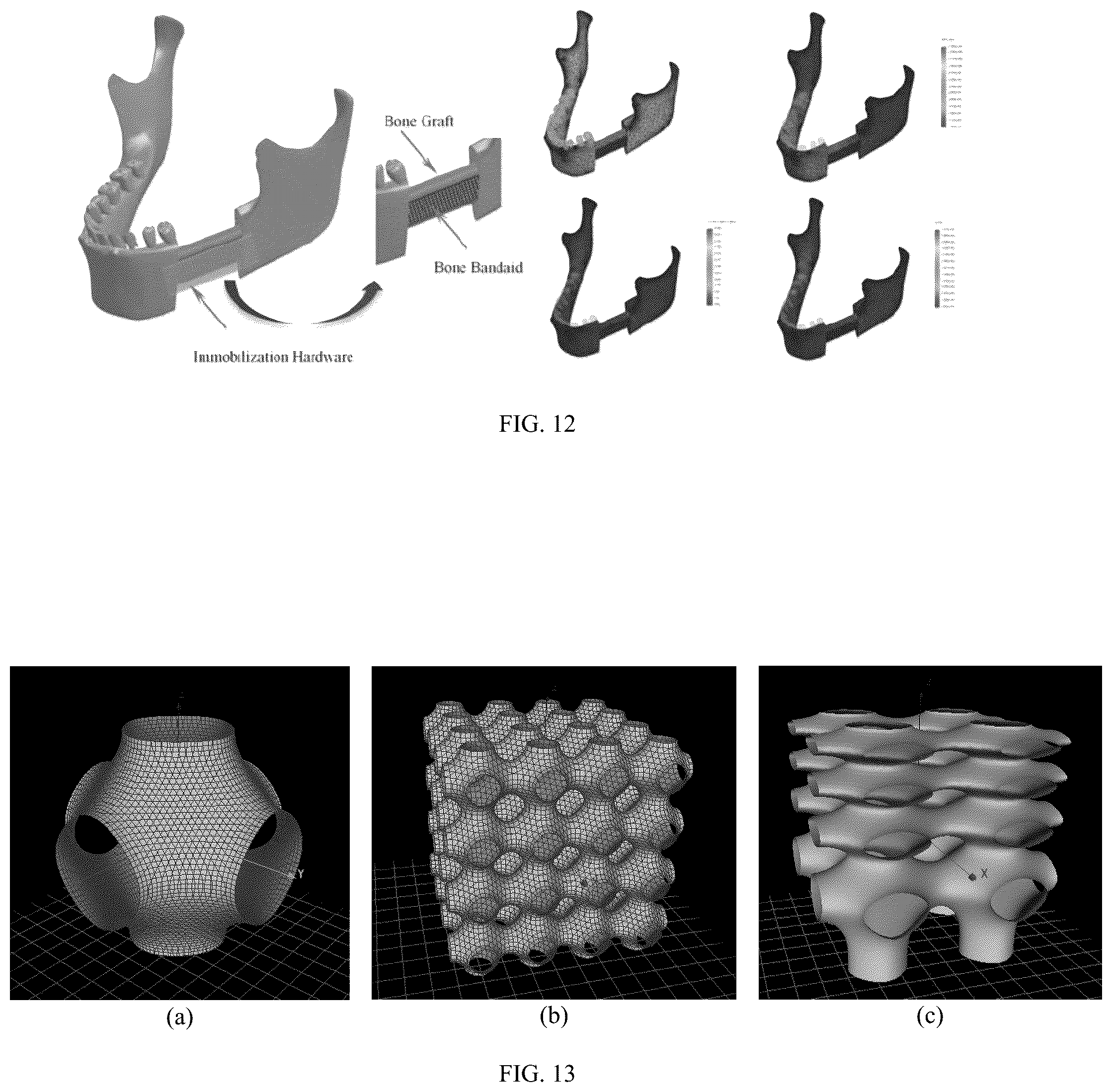 Patent US12137952 Figure 8 – Methods, devices, and manufacture of the devices for musculoskeletal reconstructive surgery