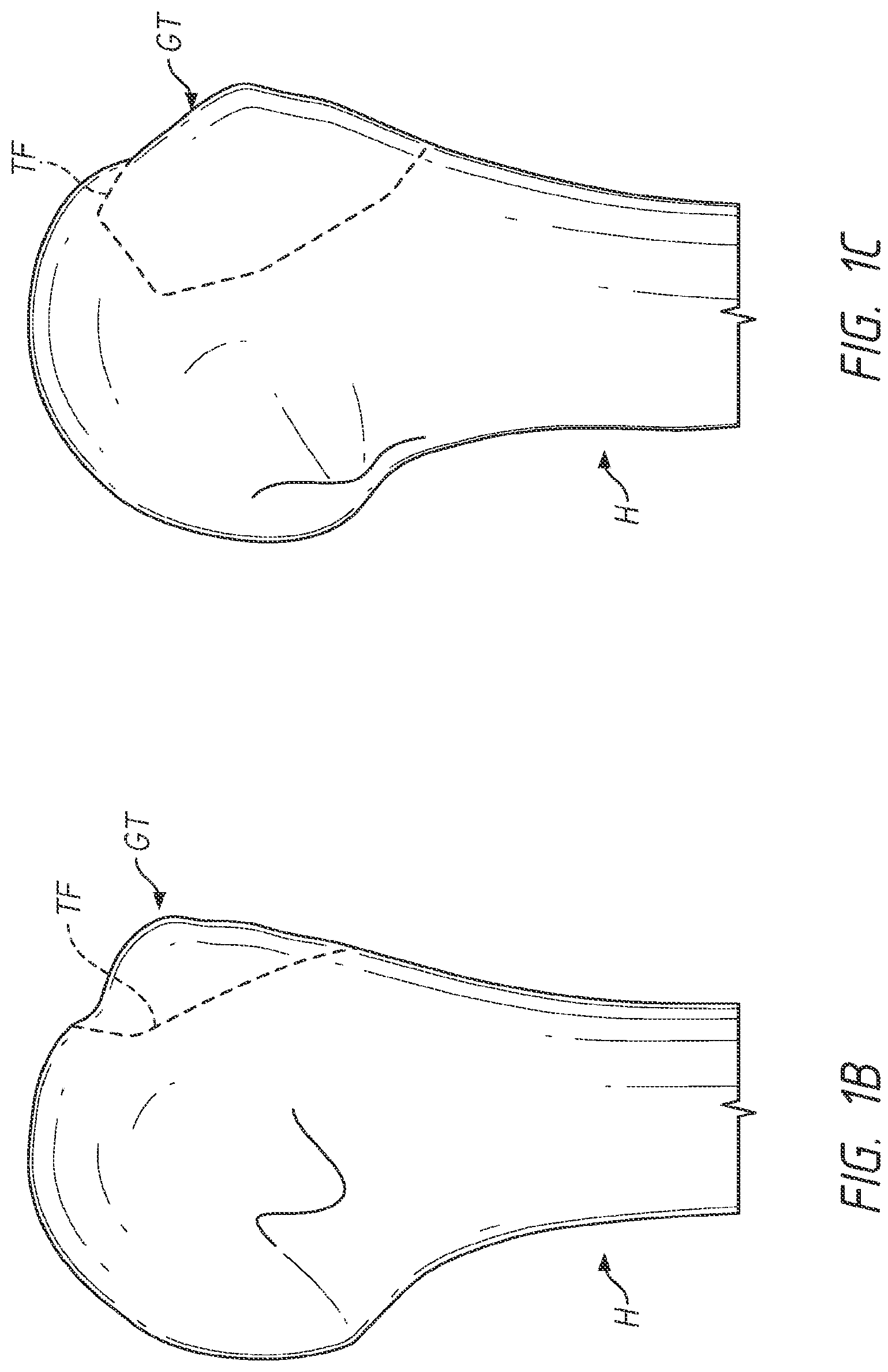 Patent US12137953 Figure 2 – Humeral fixation plates