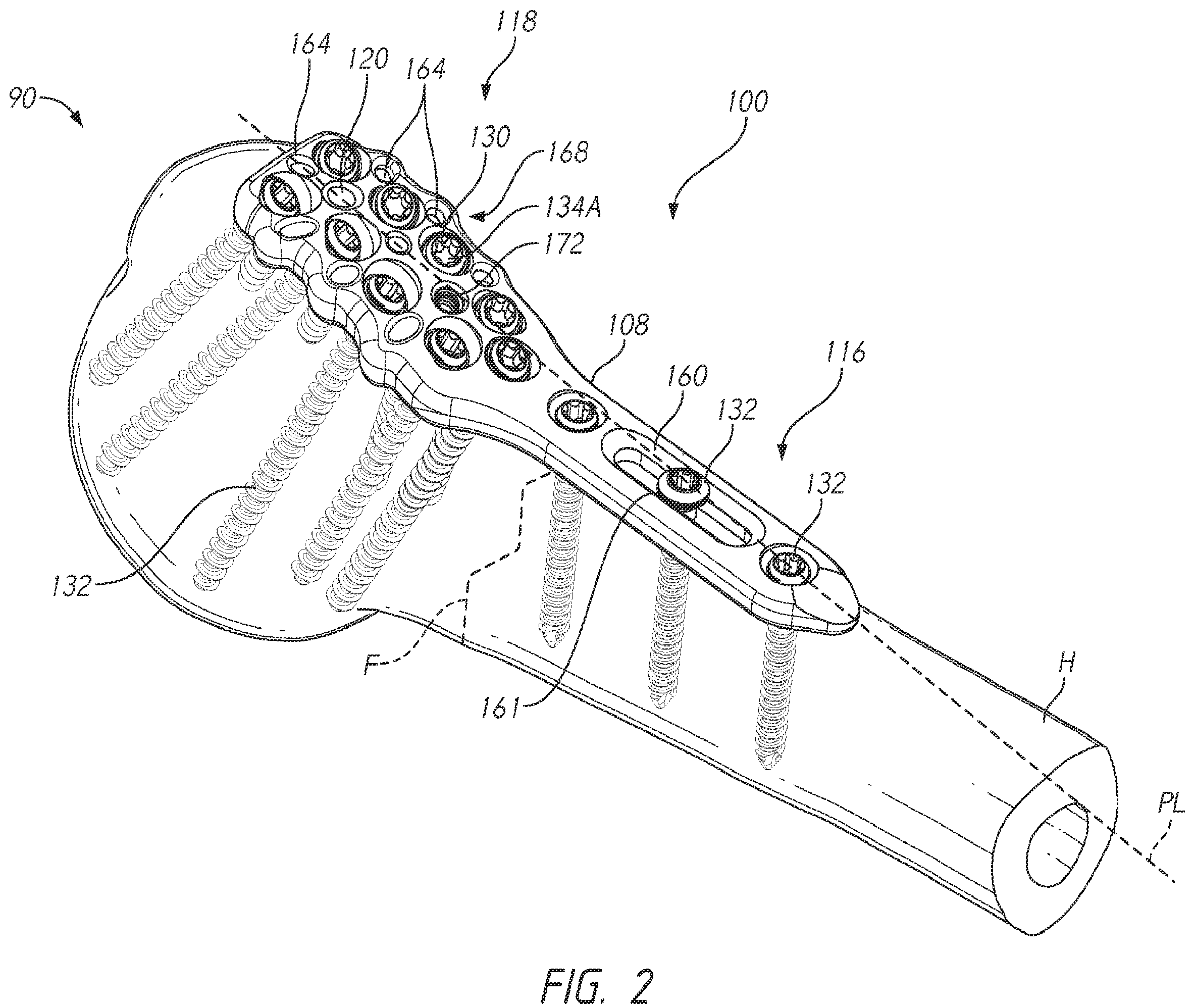 Patent US12137953 Figure 3 – Humeral fixation plates