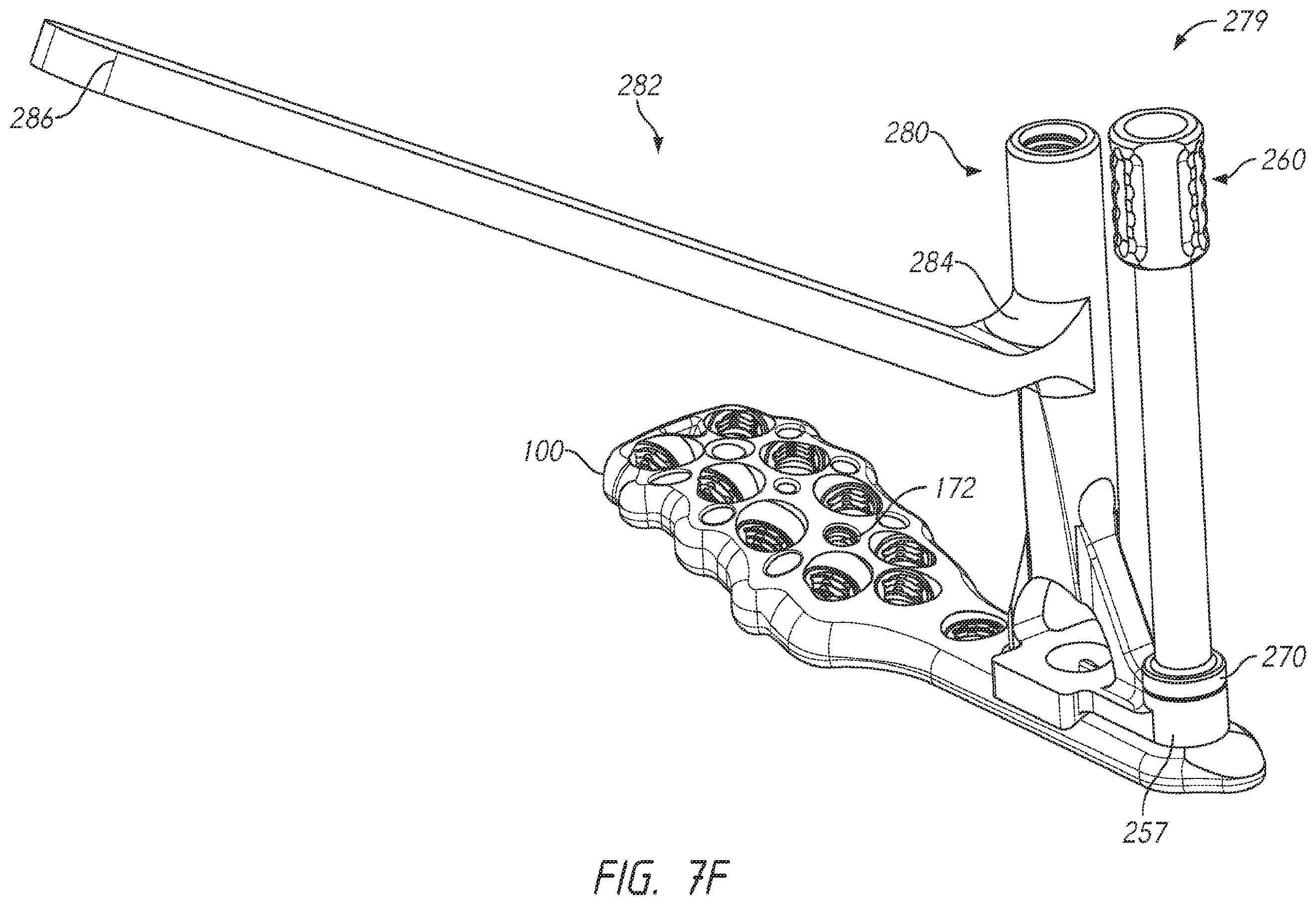 Patent US12137953 Figure 13 – Humeral fixation plates