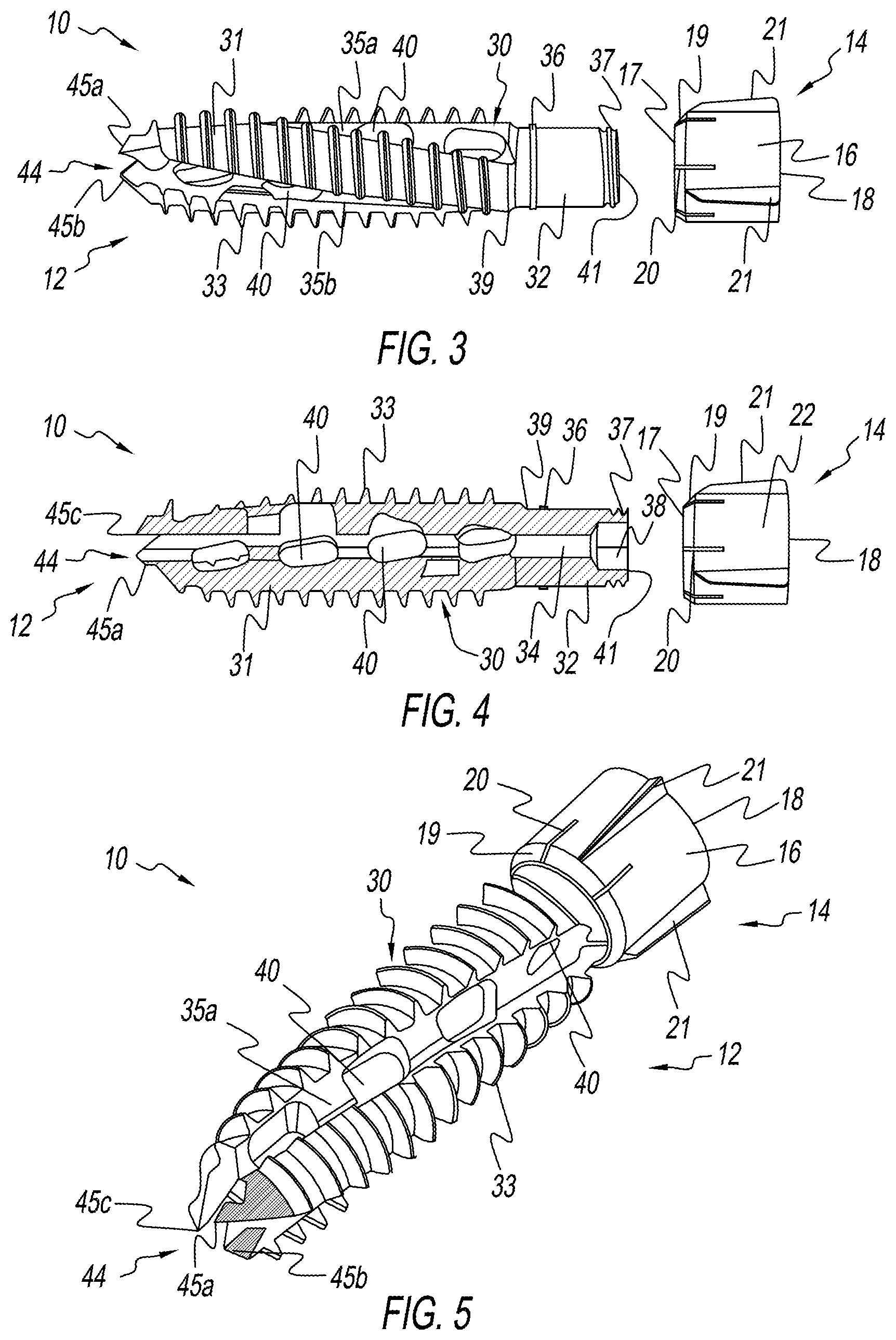 Patent US12137954 Figure 2 – Bone screw implant for sacroiliac joint fusion