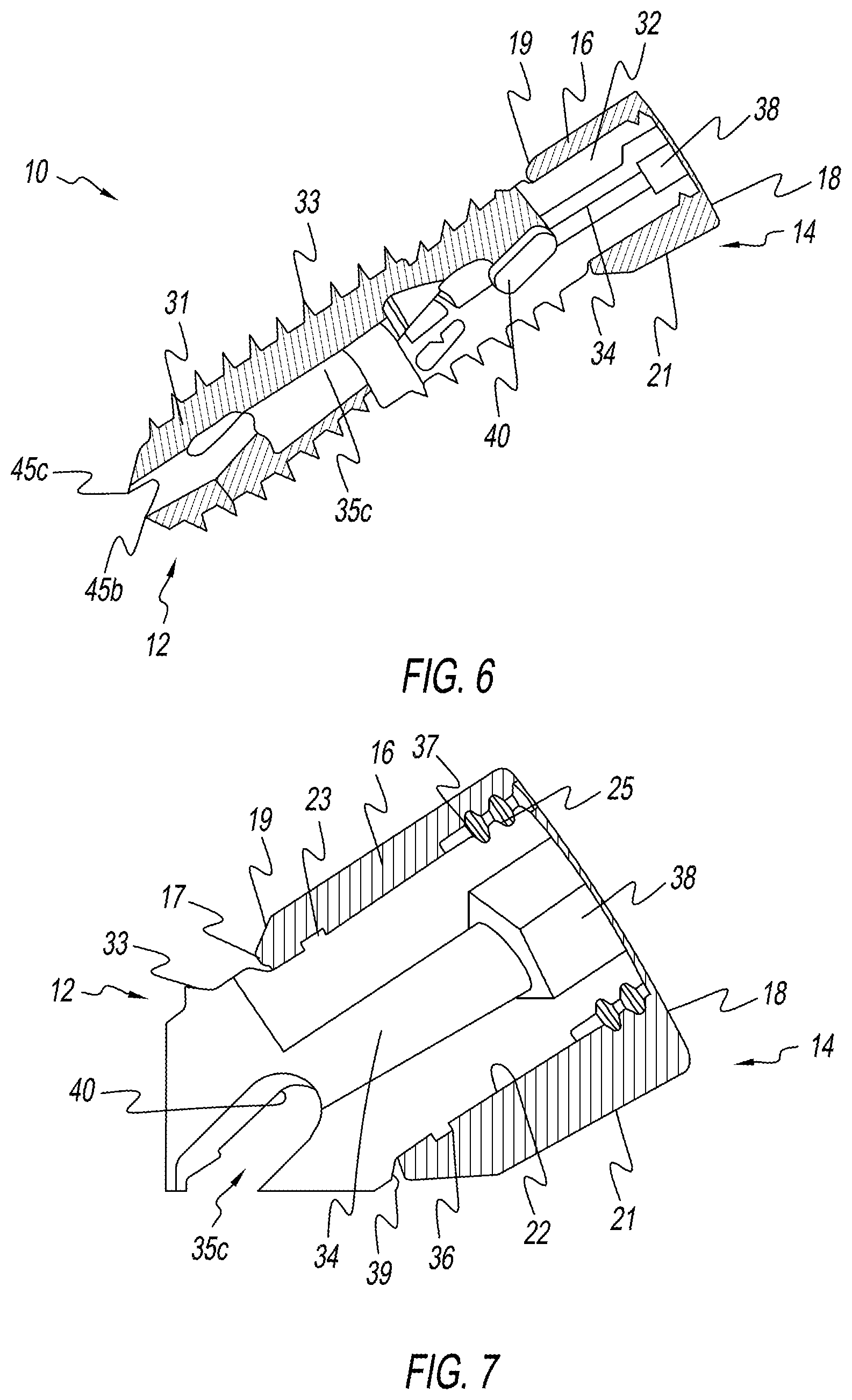 Patent US12137954 Figure 3 – Bone screw implant for sacroiliac joint fusion