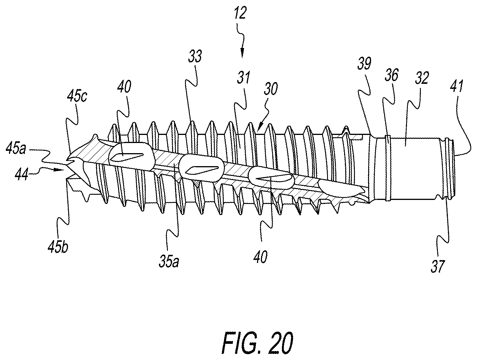 Patent US12137954 Figure 10 – Bone screw implant for sacroiliac joint fusion