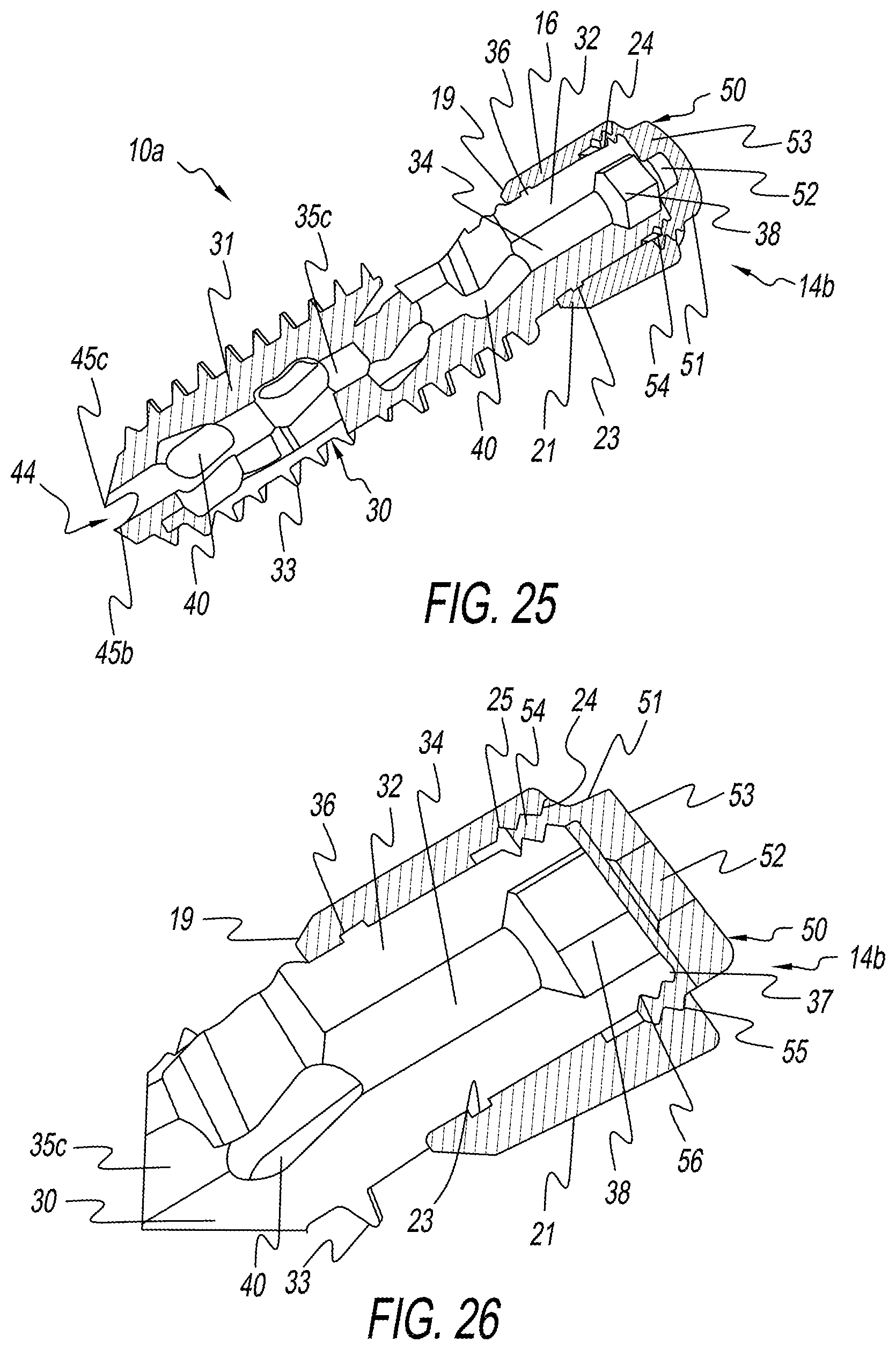 Patent US12137954 Figure 13 – Bone screw implant for sacroiliac joint fusion