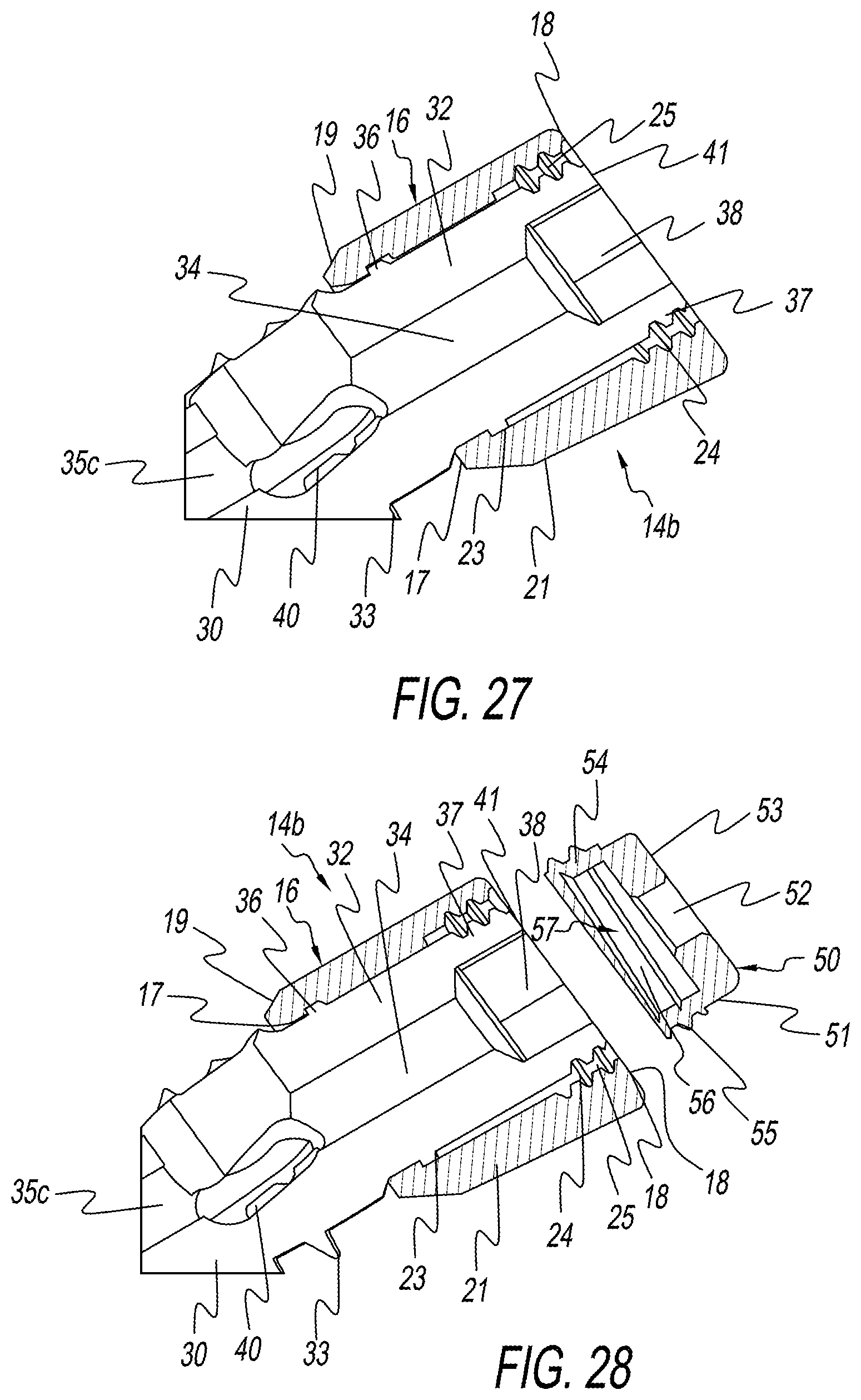 Patent US12137954 Figure 14 – Bone screw implant for sacroiliac joint fusion