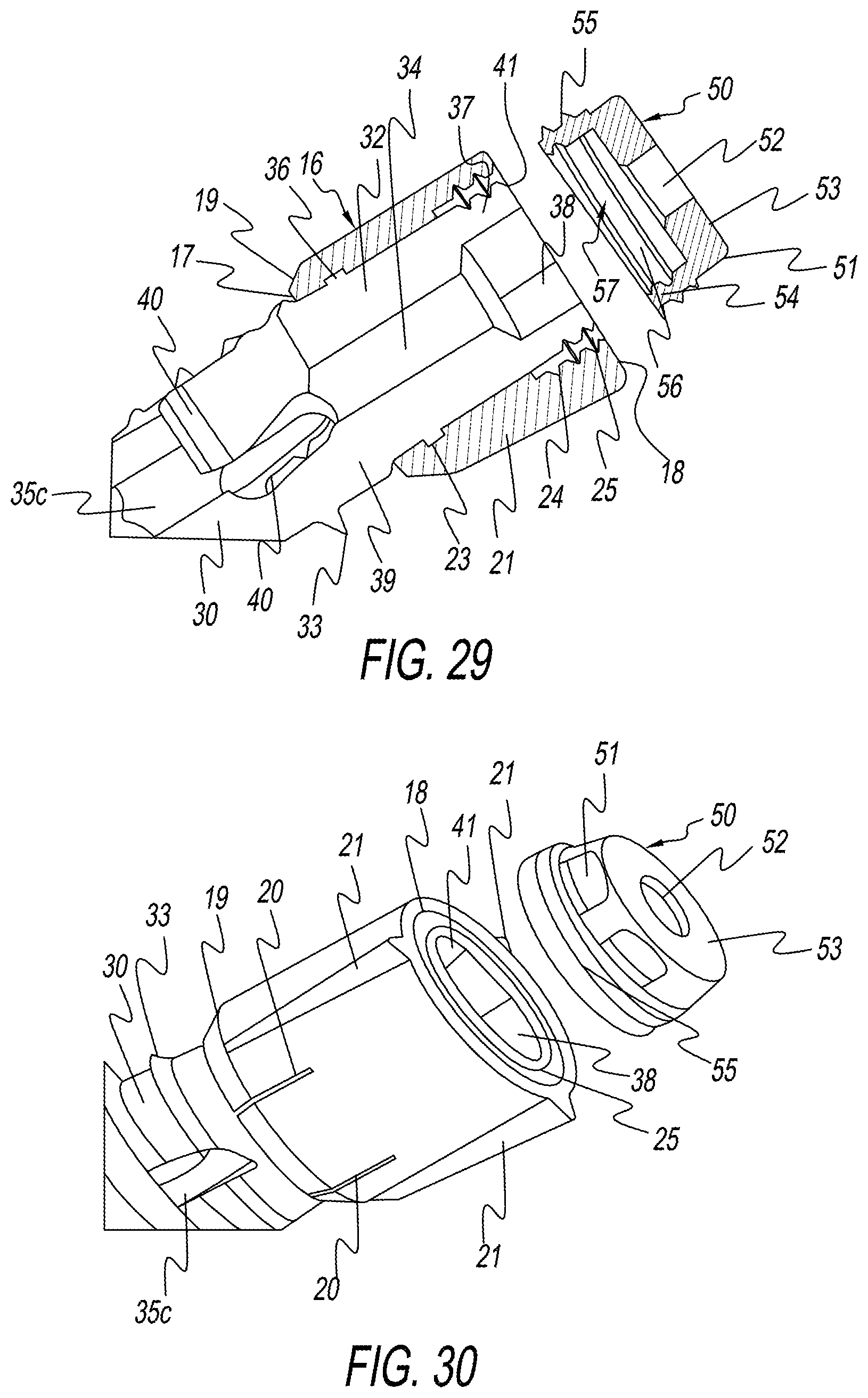 Patent US12137954 Figure 15 – Bone screw implant for sacroiliac joint fusion