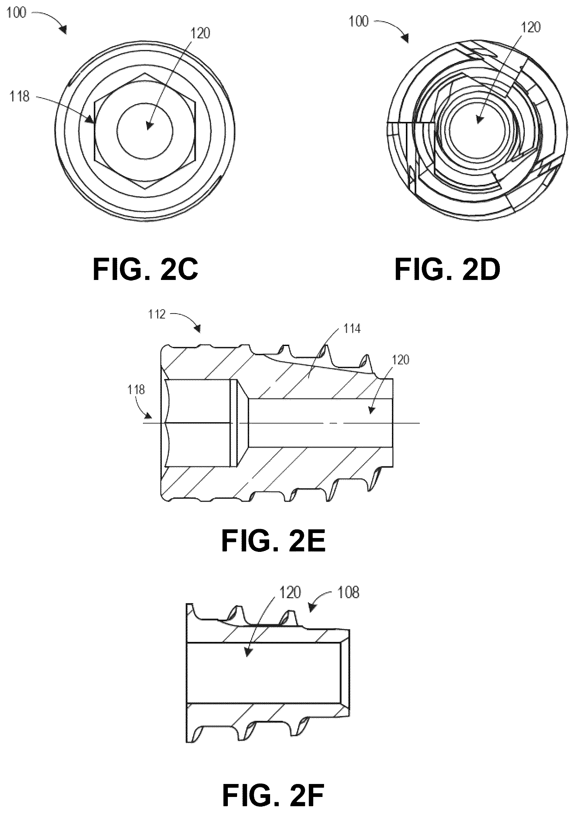 Patent US12137956 Figure 3 – Orthopedic implants and instruments for delivering the same
