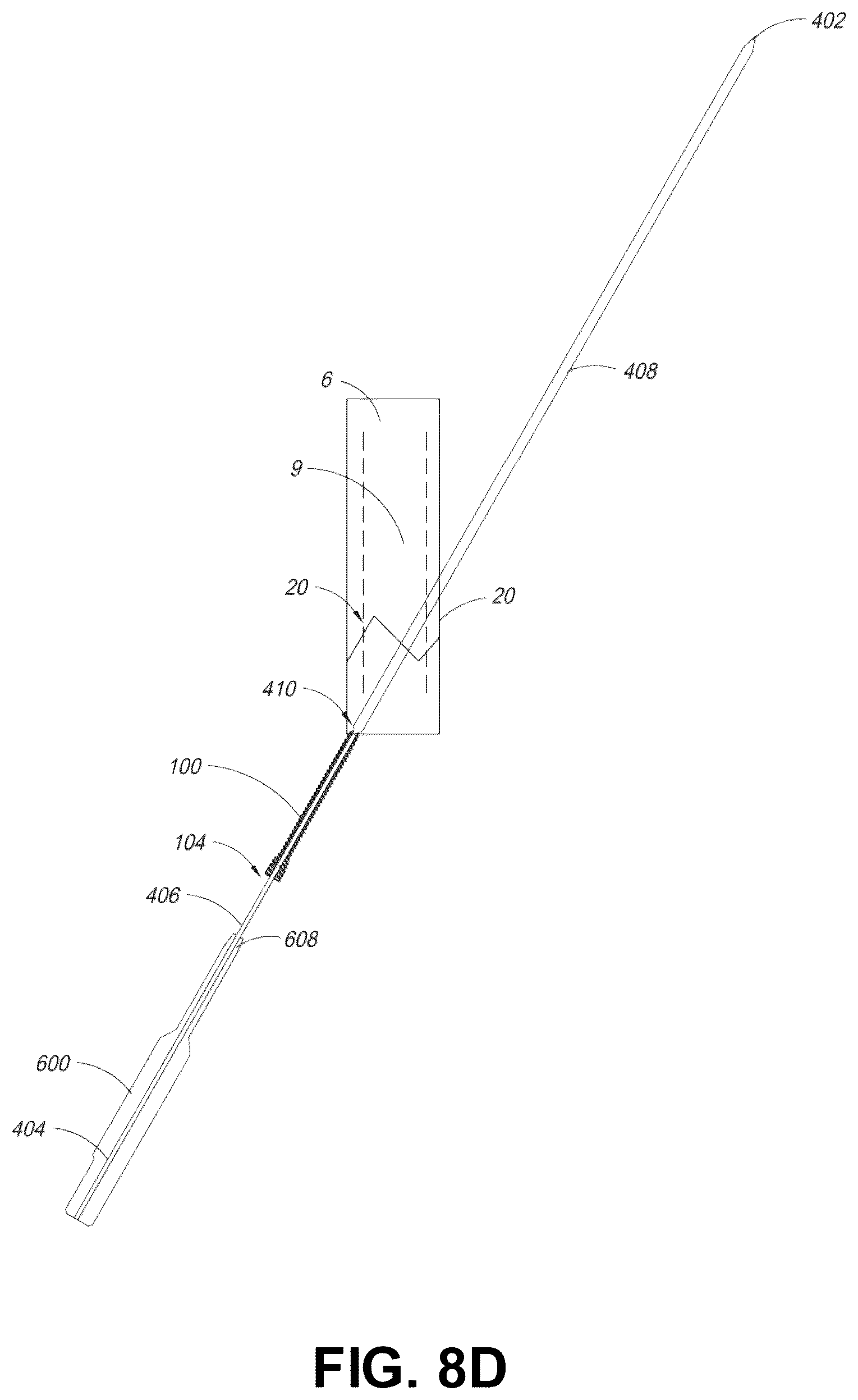 Patent US12137956 Figure 12 – Orthopedic implants and instruments for delivering the same