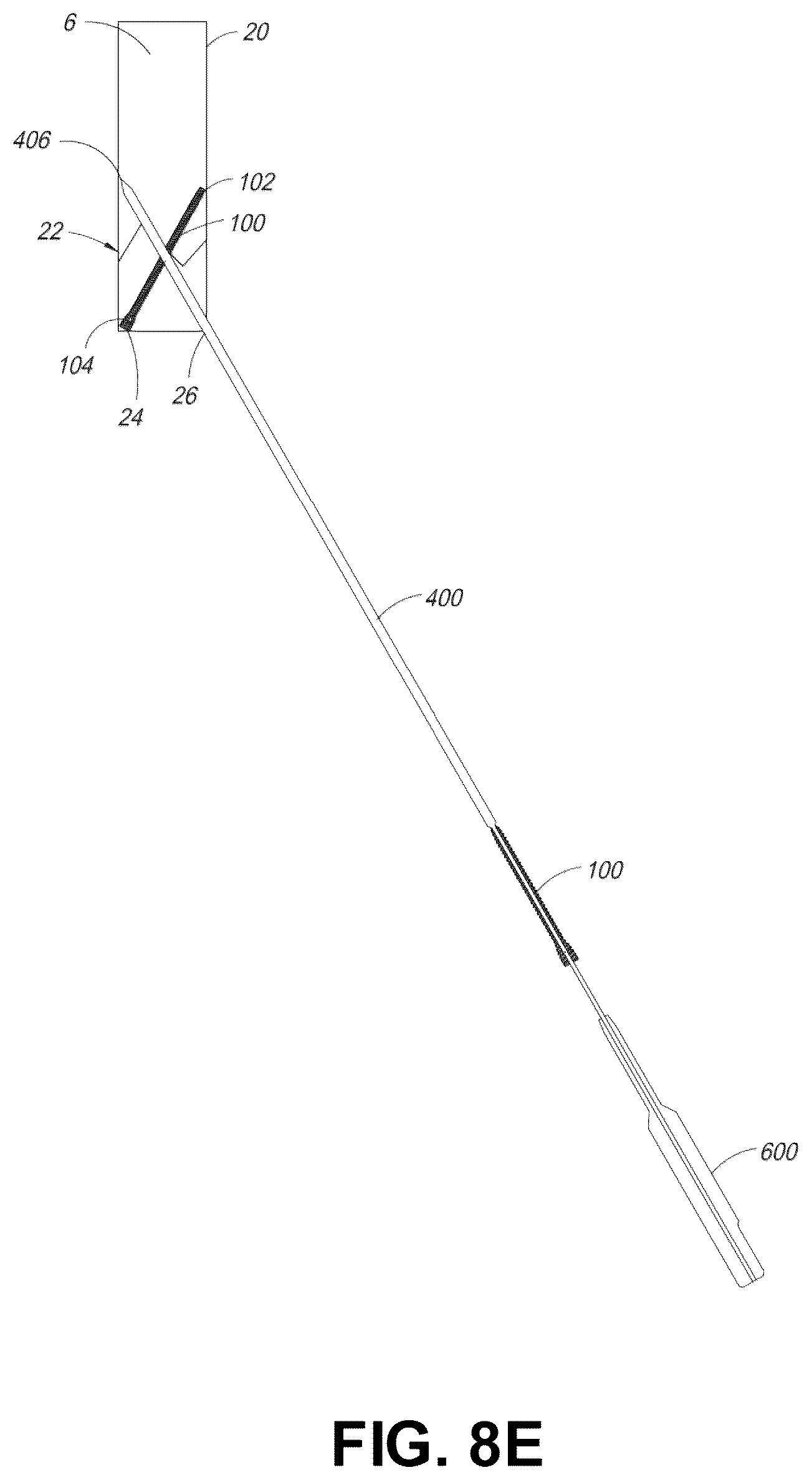 Patent US12137956 Figure 13 – Orthopedic implants and instruments for delivering the same