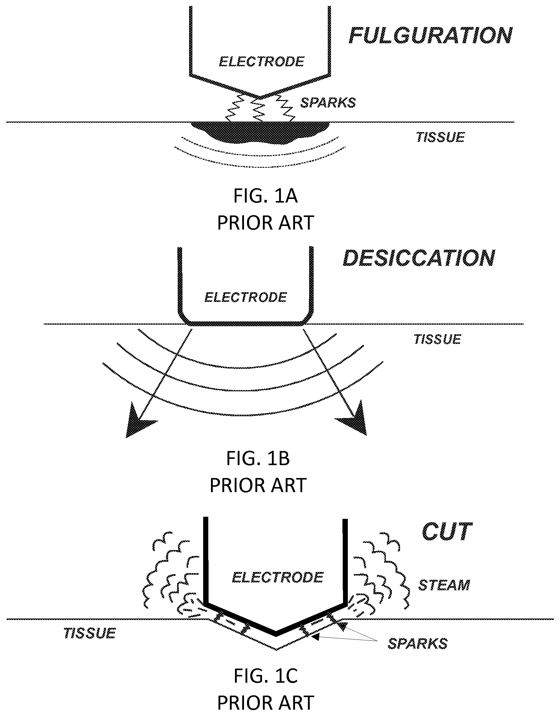 Patent US12137958 Figure 1 – System and method for electrosurgical conductive gas cutting for improving eschar, sealing vessels and tissues