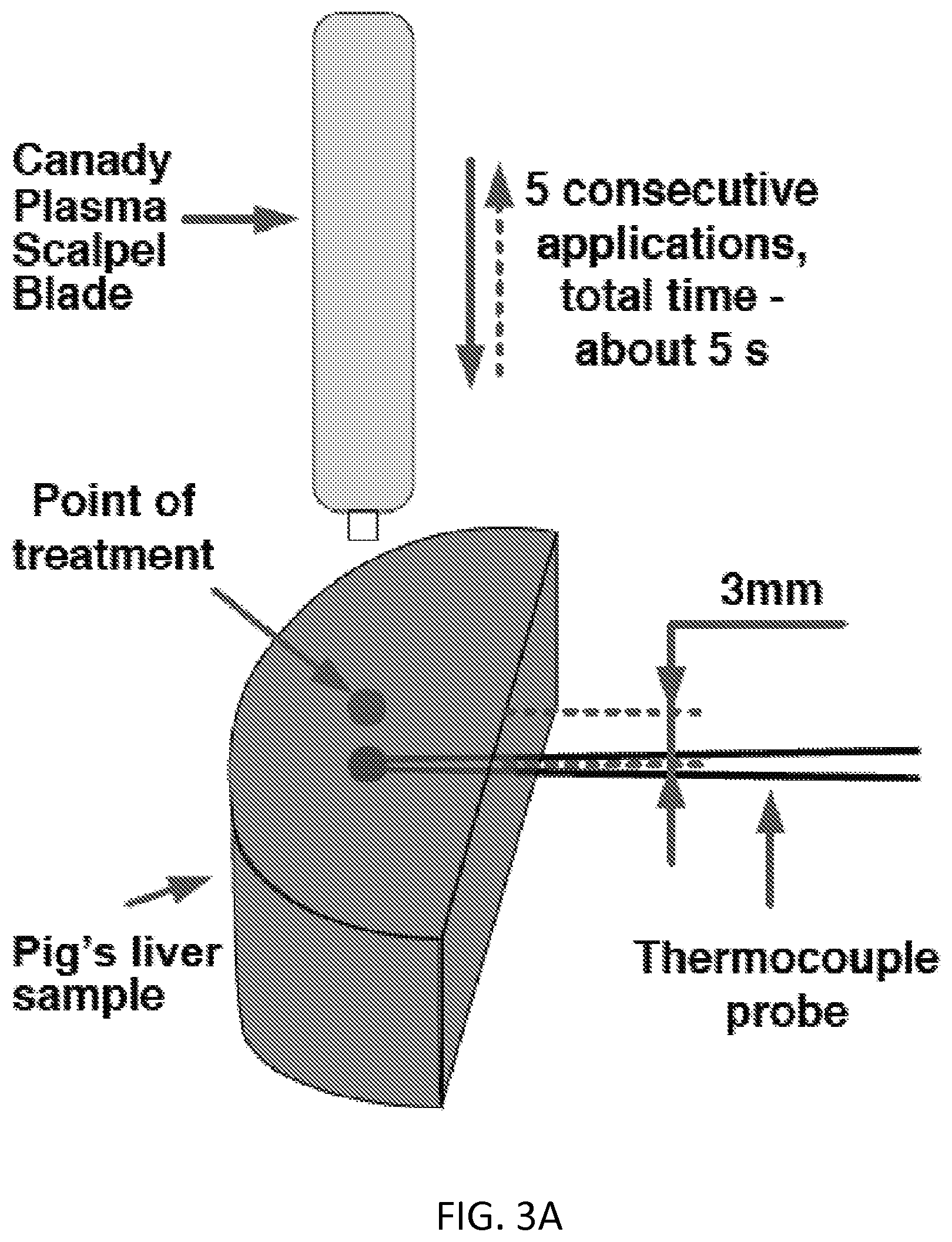 Patent US12137958 Figure 5 – System and method for electrosurgical conductive gas cutting for improving eschar, sealing vessels and tissues