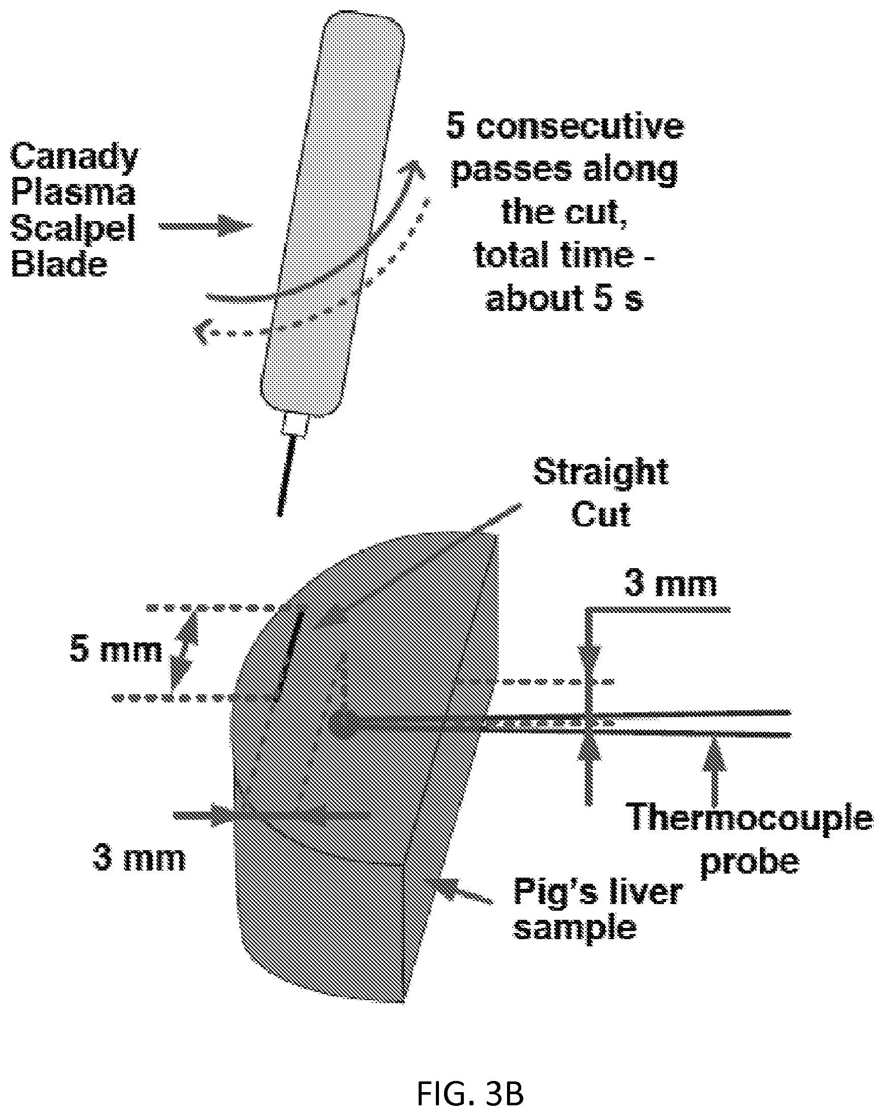 Patent US12137958 Figure 6 – System and method for electrosurgical conductive gas cutting for improving eschar, sealing vessels and tissues