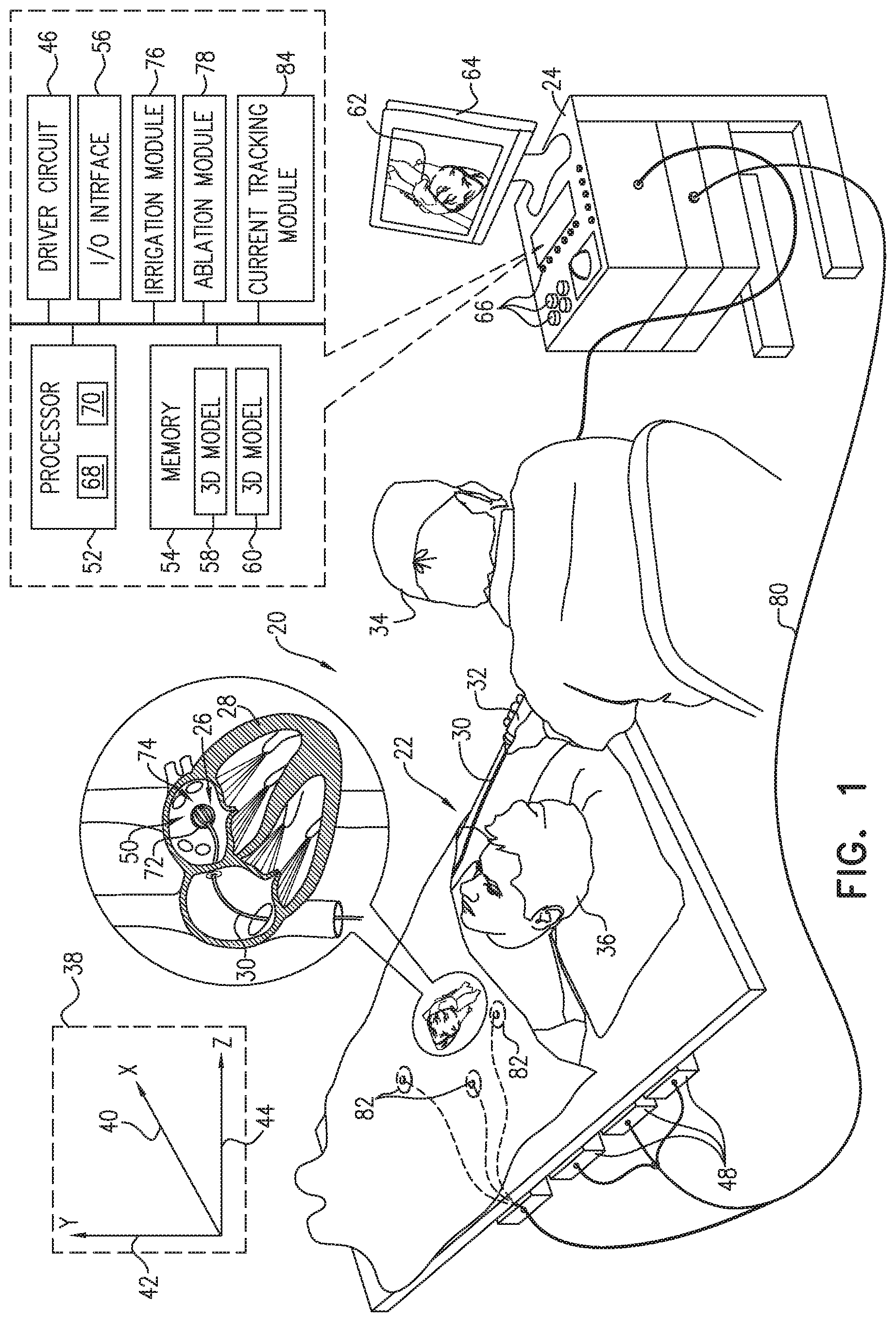 Patent US12137967 Figure 1 – Accurate positioning and shape visualization of balloon catheter ablation tags