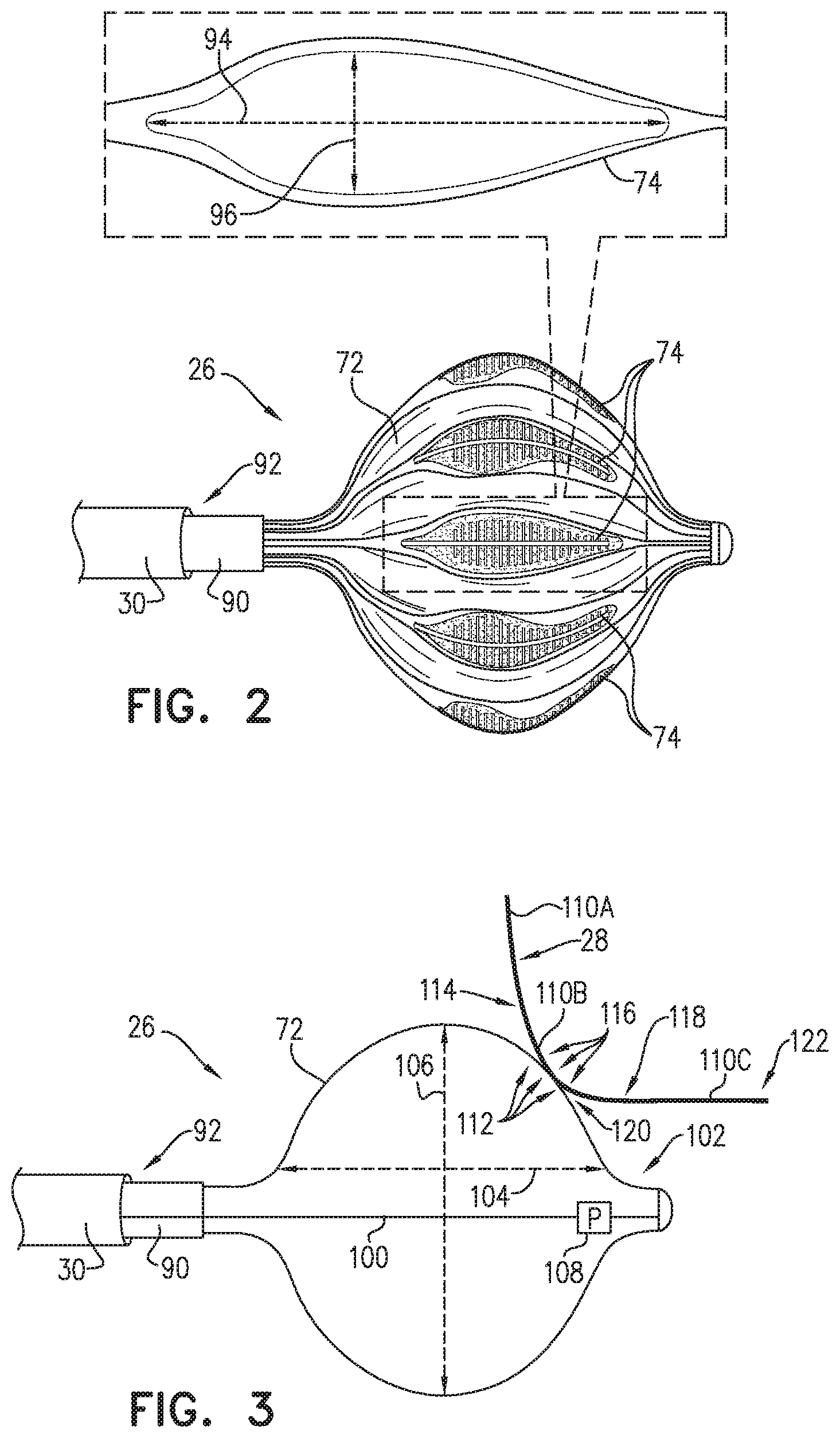 Patent US12137967 Figure 2 – Accurate positioning and shape visualization of balloon catheter ablation tags
