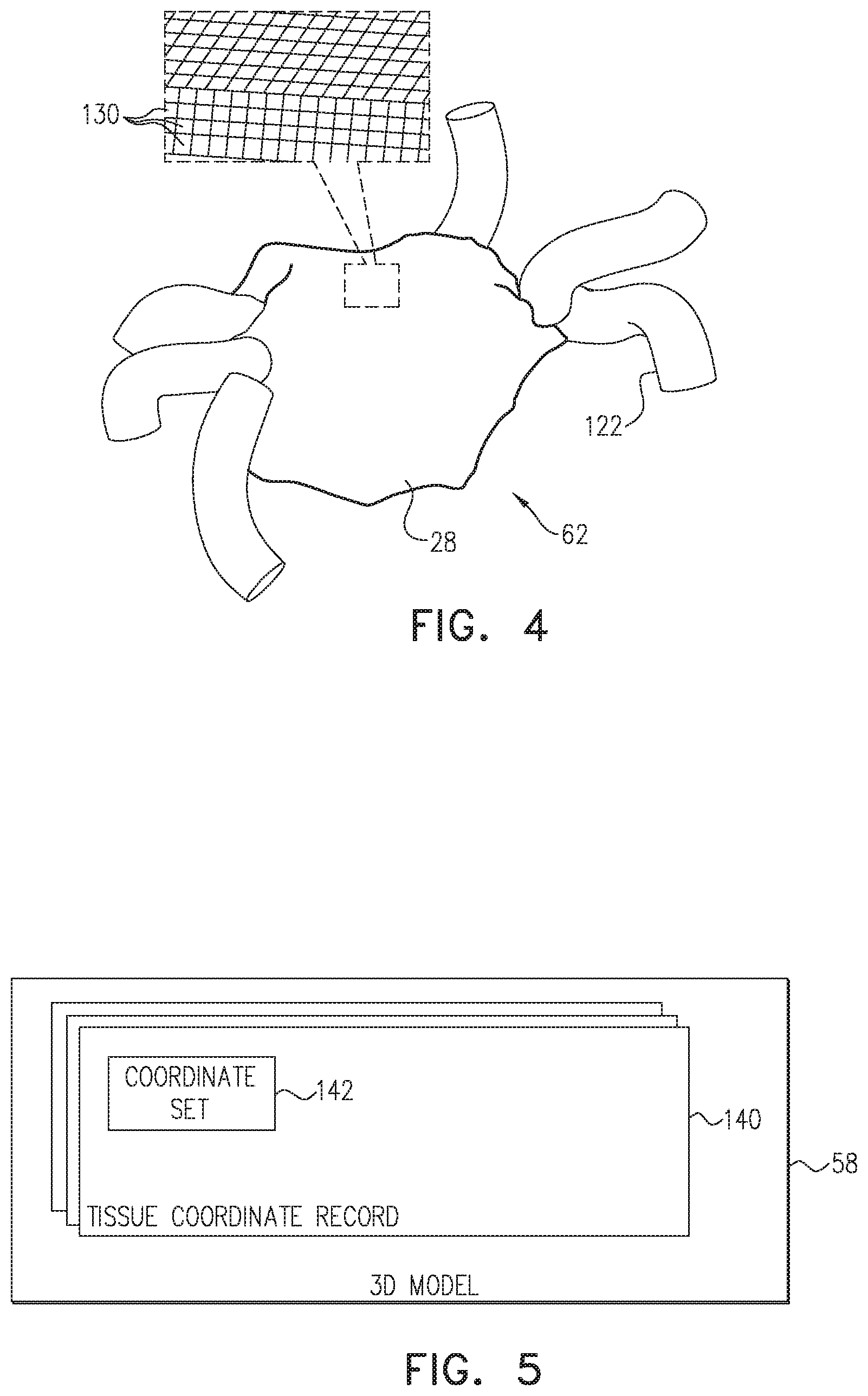 Patent US12137967 Figure 3 – Accurate positioning and shape visualization of balloon catheter ablation tags
