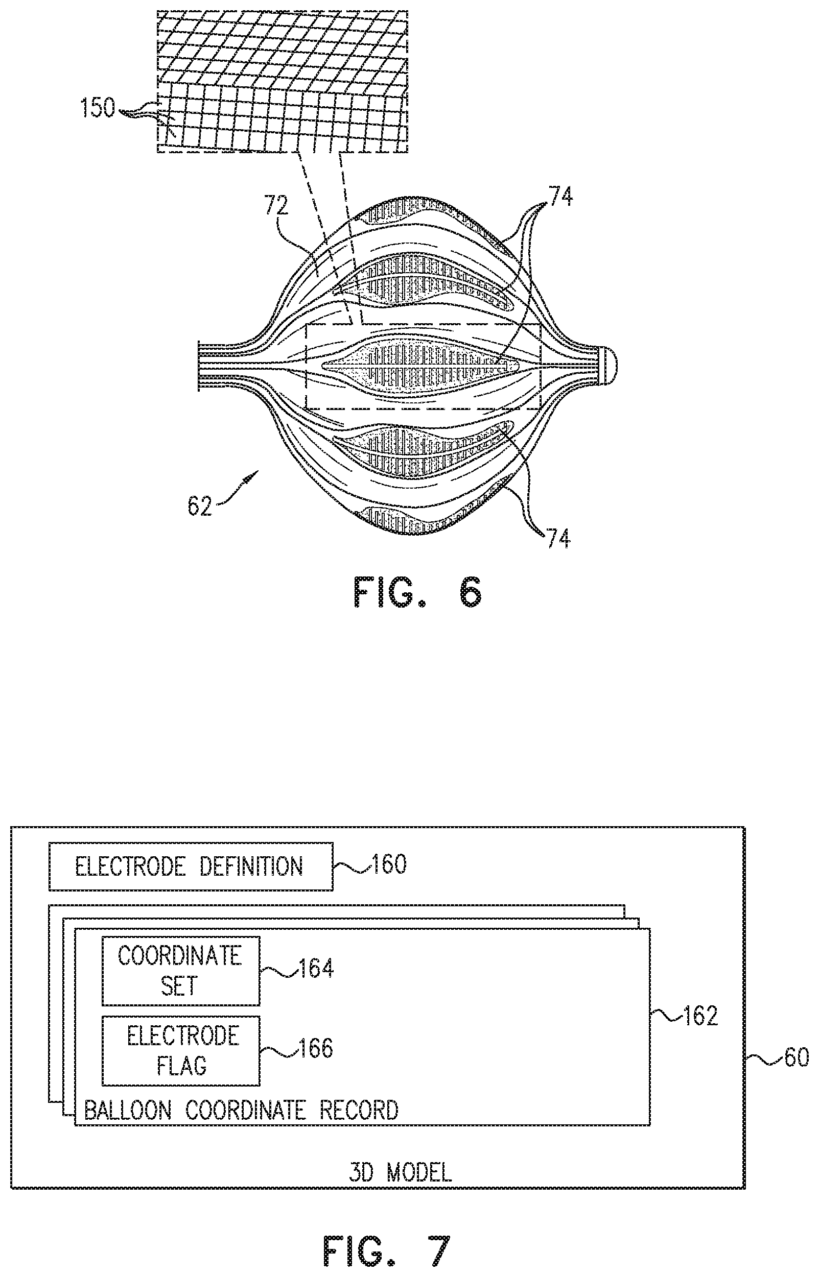 Patent US12137967 Figure 4 – Accurate positioning and shape visualization of balloon catheter ablation tags