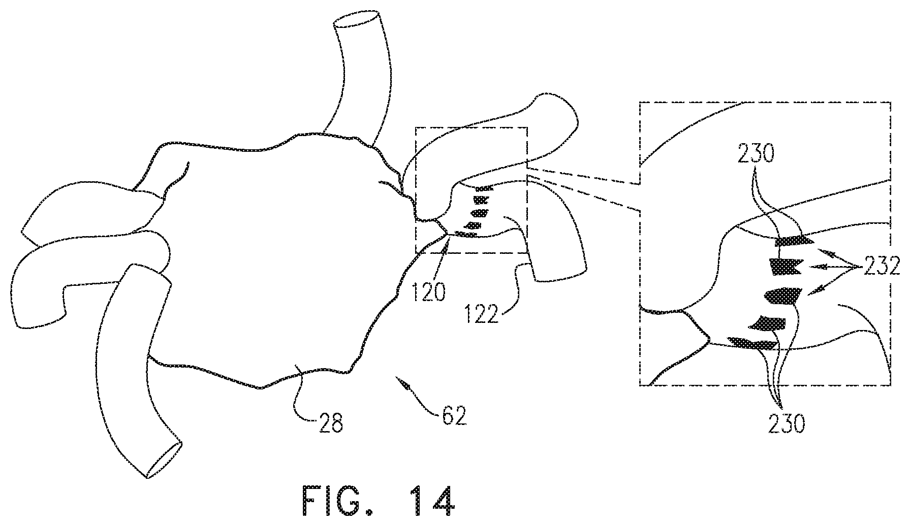 Patent US12137967 Figure 8 – Accurate positioning and shape visualization of balloon catheter ablation tags