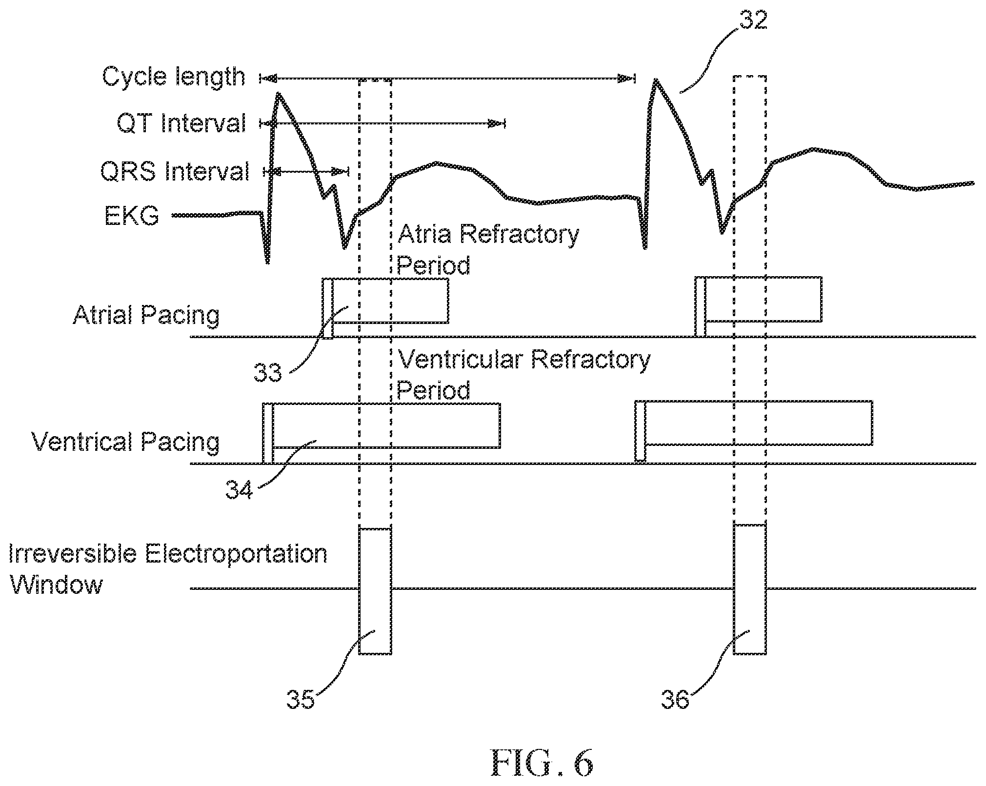 Patent US12137968 Figure 6 – Methods and apparatus for multi-catheter tissue ablation