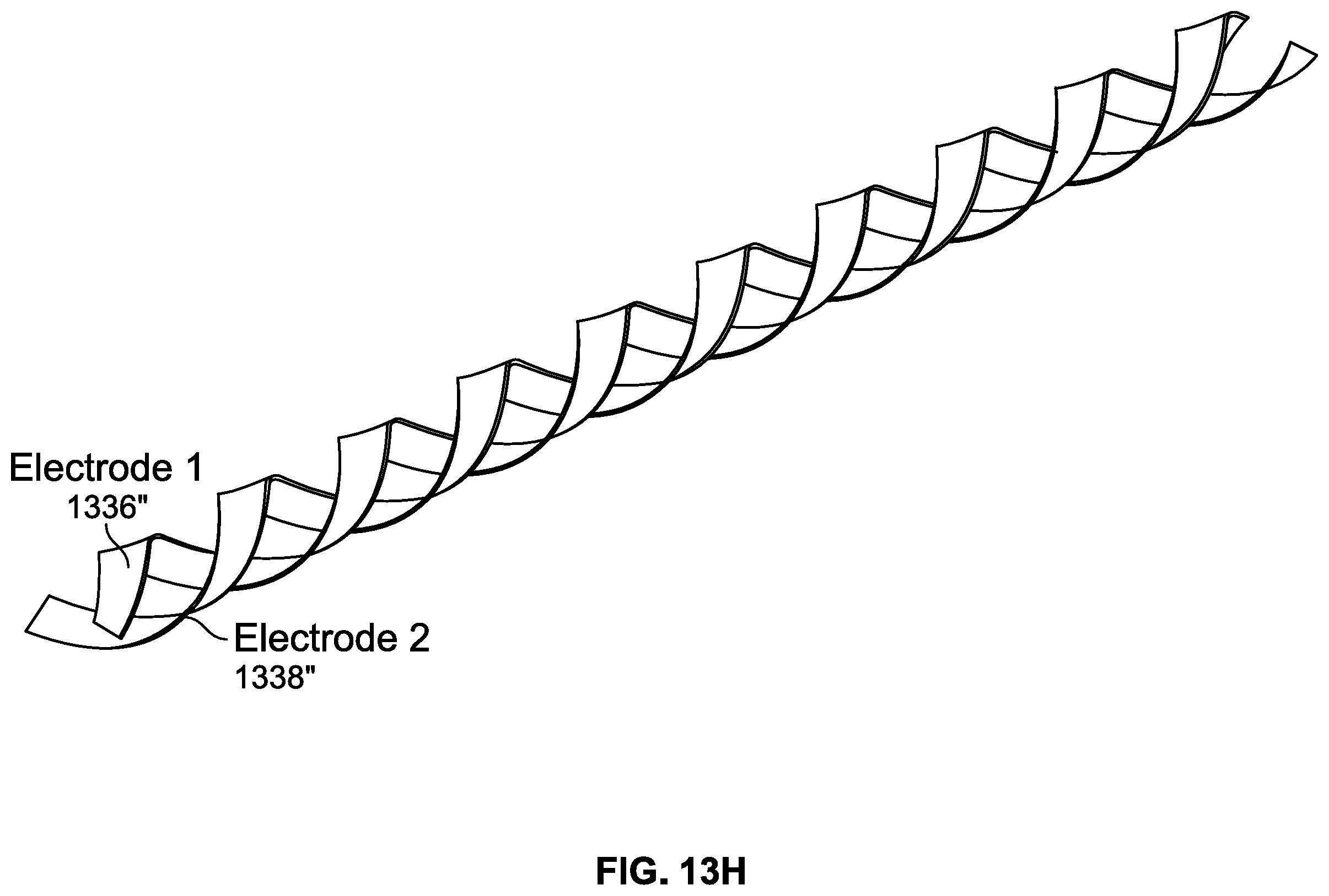 Patent US12137969 Figure 20 – Heated vapor ablation systems and methods for treating cardiac conditions