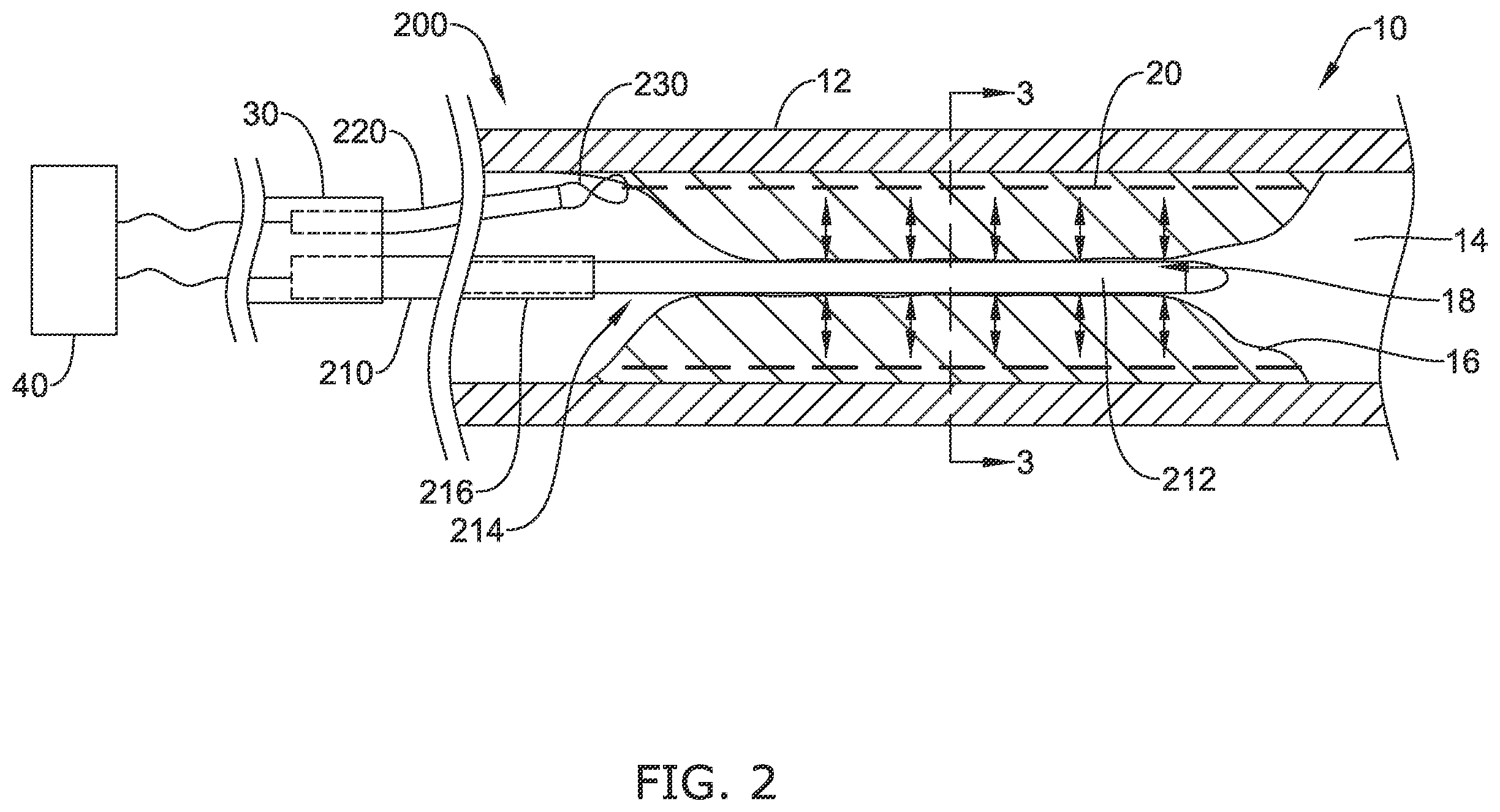 Patent US12137970 Figure 2 – Devices and methods for inducing ablation in or around occluded implants