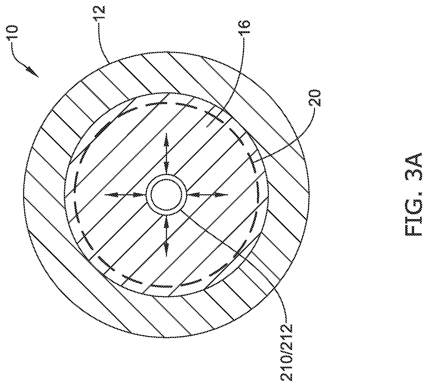 Patent US12137970 Figure 3 – Devices and methods for inducing ablation in or around occluded implants