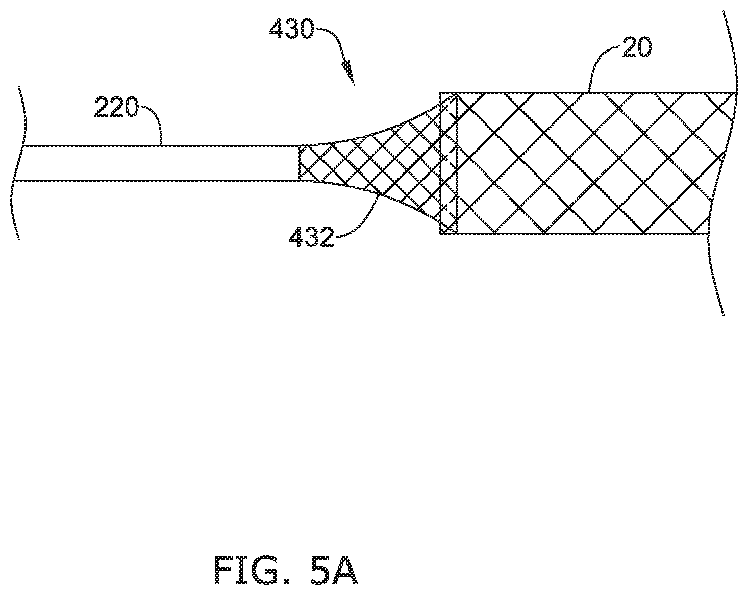 Patent US12137970 Figure 6 – Devices and methods for inducing ablation in or around occluded implants