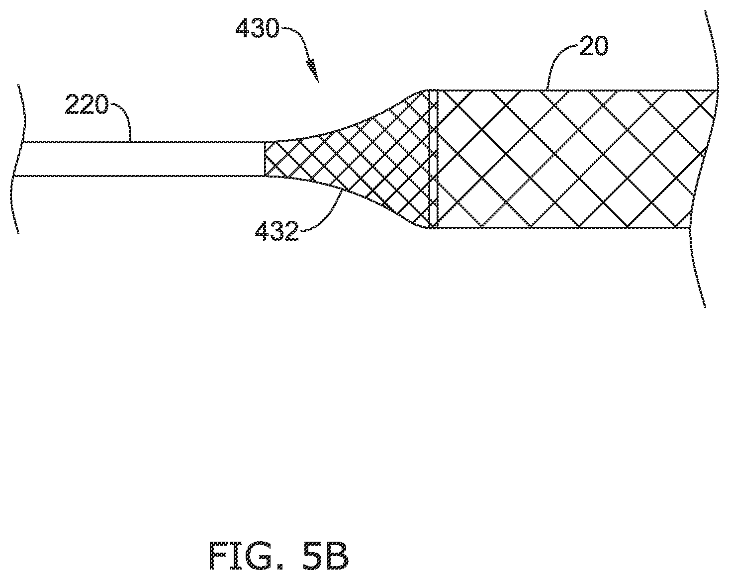 Patent US12137970 Figure 7 – Devices and methods for inducing ablation in or around occluded implants