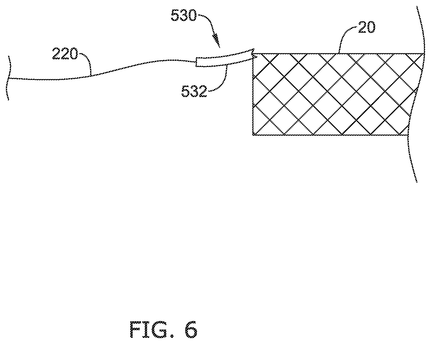 Patent US12137970 Figure 8 – Devices and methods for inducing ablation in or around occluded implants