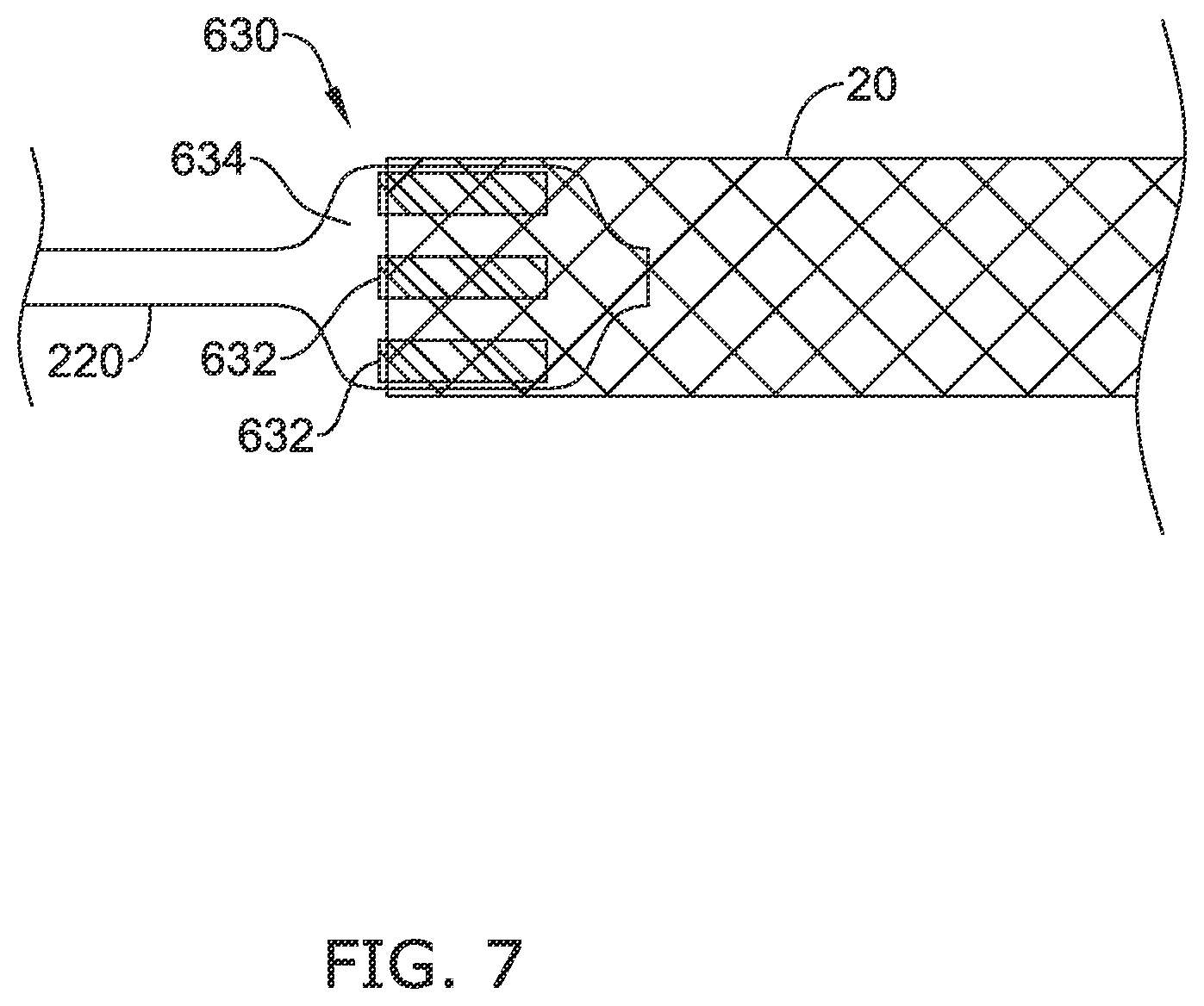Patent US12137970 Figure 9 – Devices and methods for inducing ablation in or around occluded implants