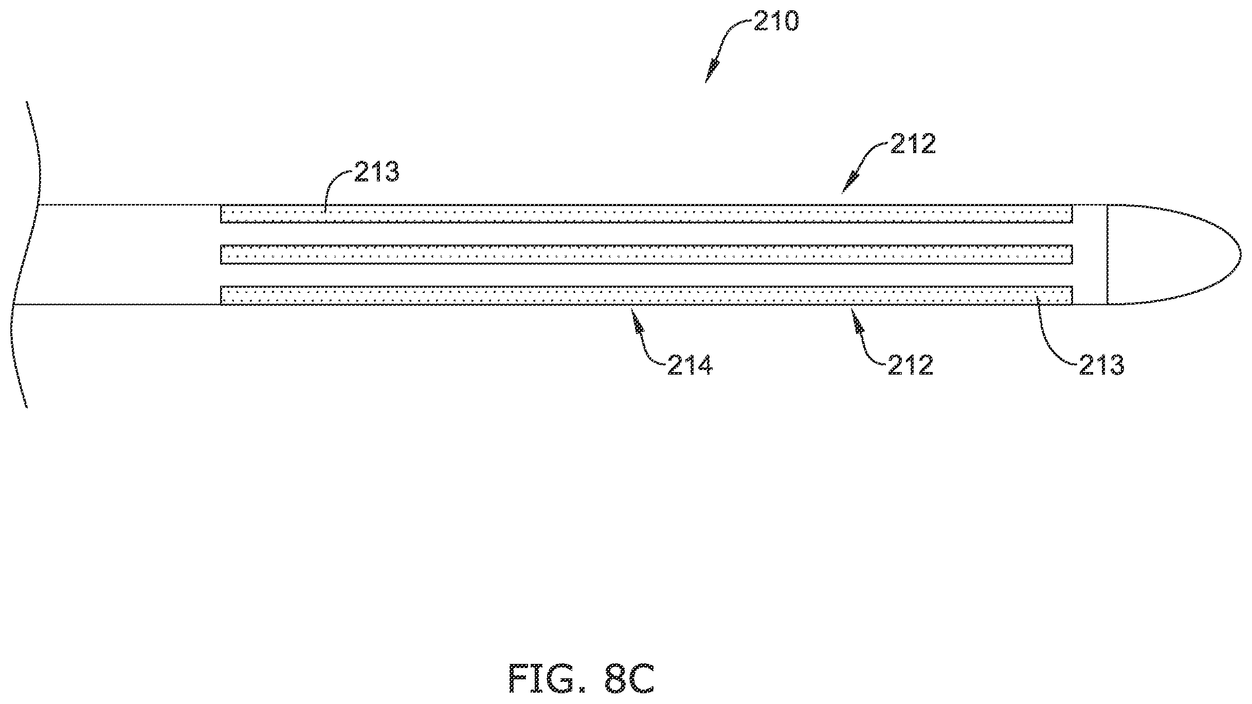 Patent US12137970 Figure 12 – Devices and methods for inducing ablation in or around occluded implants