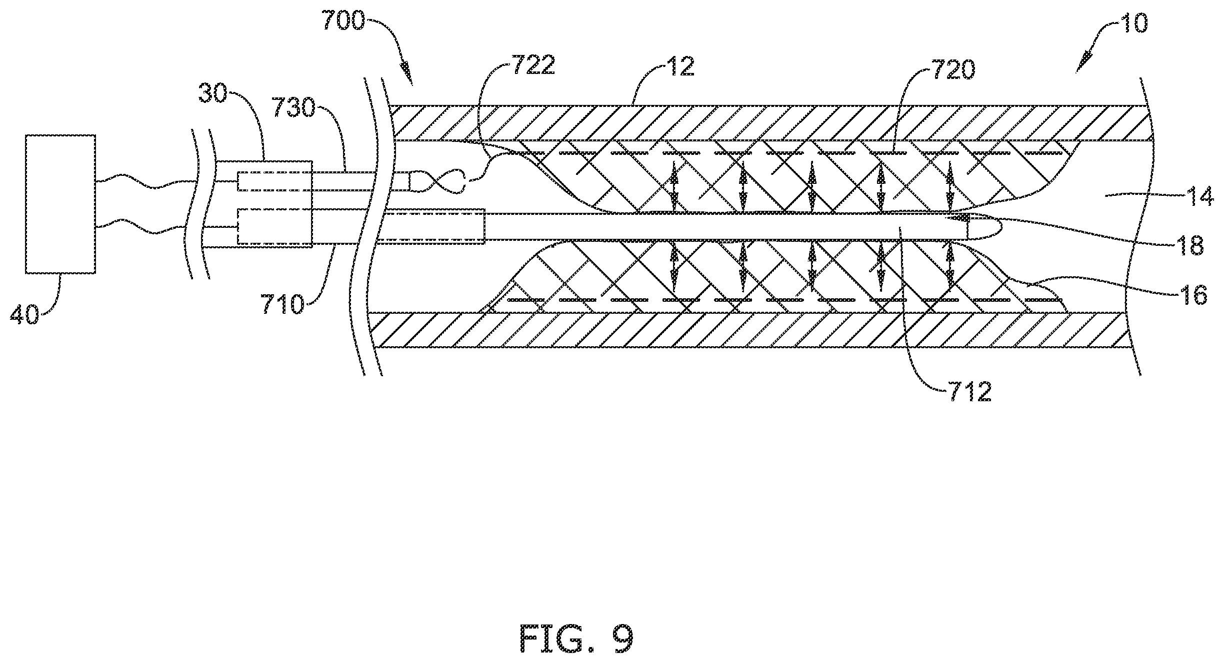 Patent US12137970 Figure 14 – Devices and methods for inducing ablation in or around occluded implants