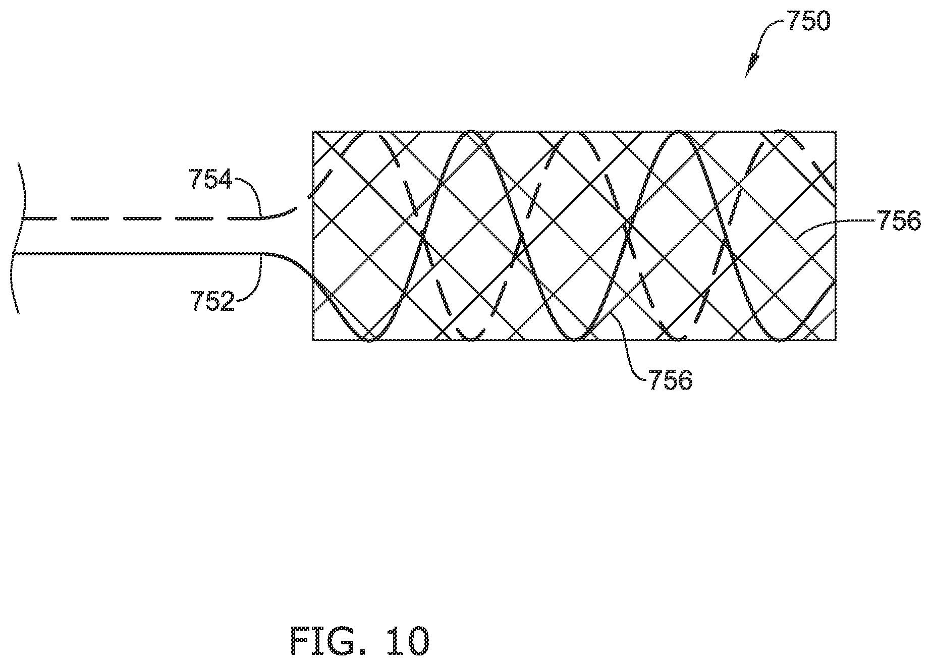 Patent US12137970 Figure 15 – Devices and methods for inducing ablation in or around occluded implants