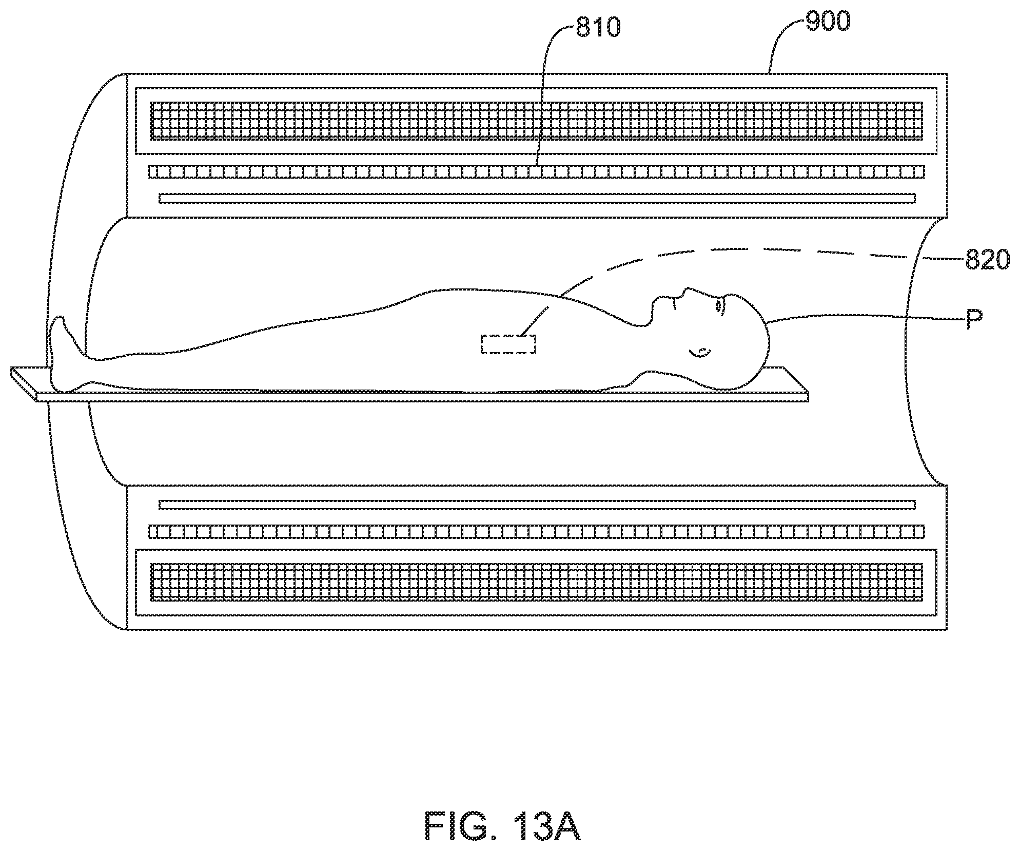 Patent US12137970 Figure 19 – Devices and methods for inducing ablation in or around occluded implants