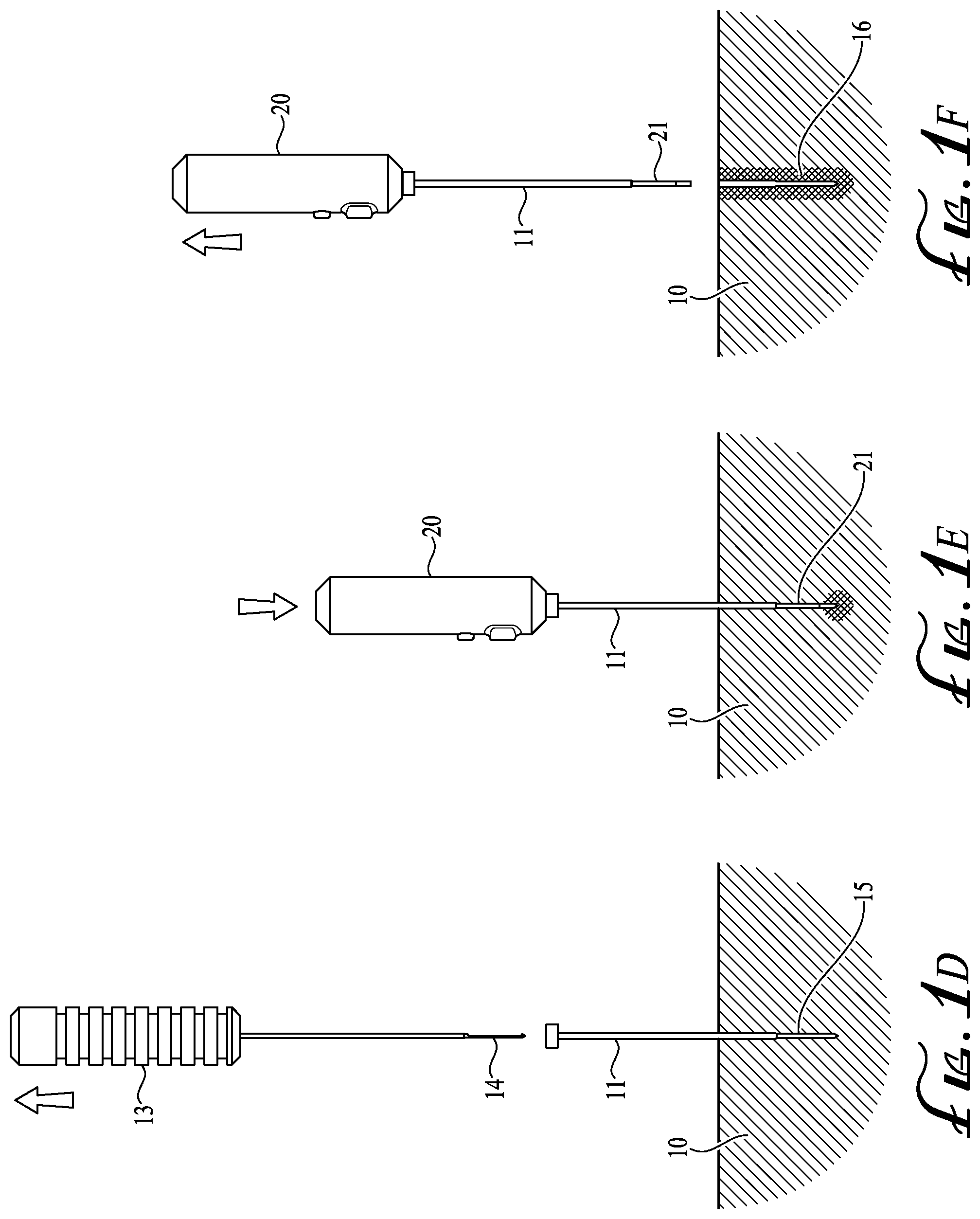 Patent US12137972 Figure 2 – Biopsy tract ablation system for tumor seeding prevention and cauterization