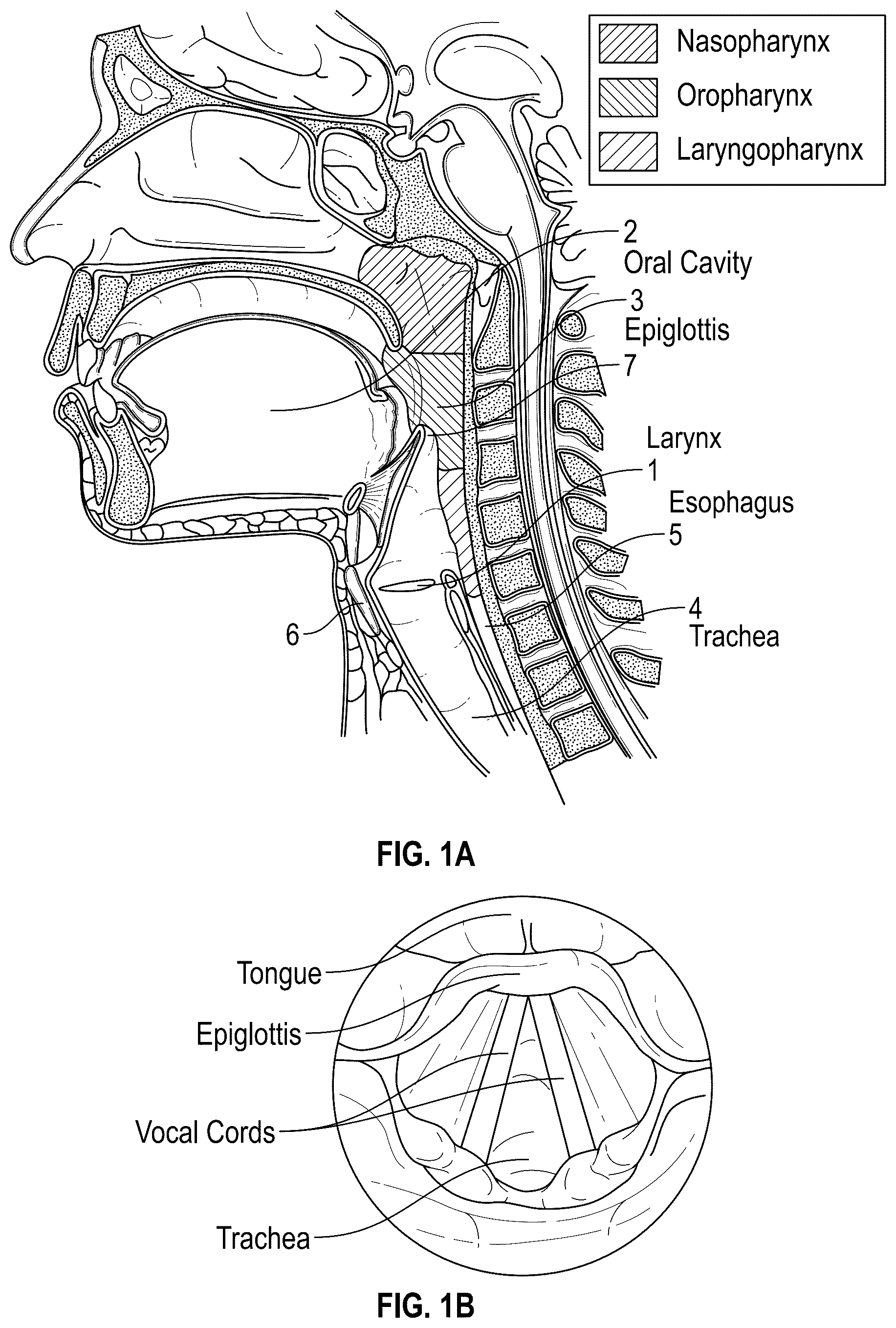Patent US12137973 Figure 1 – Apparatus and techniques for surgical laser delivery