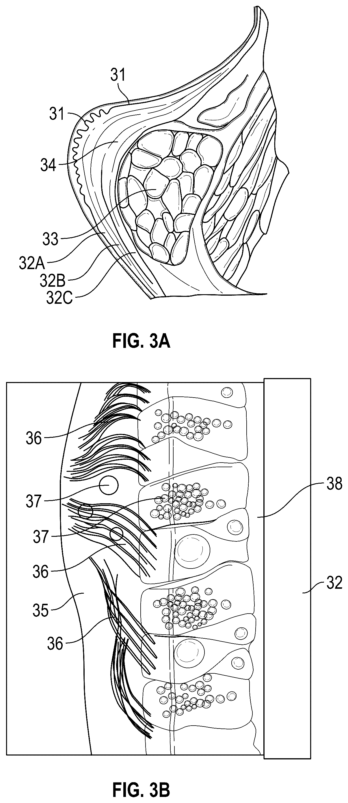 Patent US12137973 Figure 3 – Apparatus and techniques for surgical laser delivery