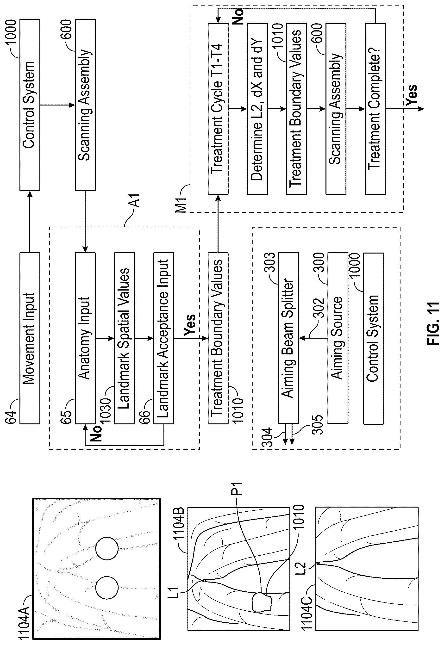 Patent US12137973 Figure 17 – Apparatus and techniques for surgical laser delivery