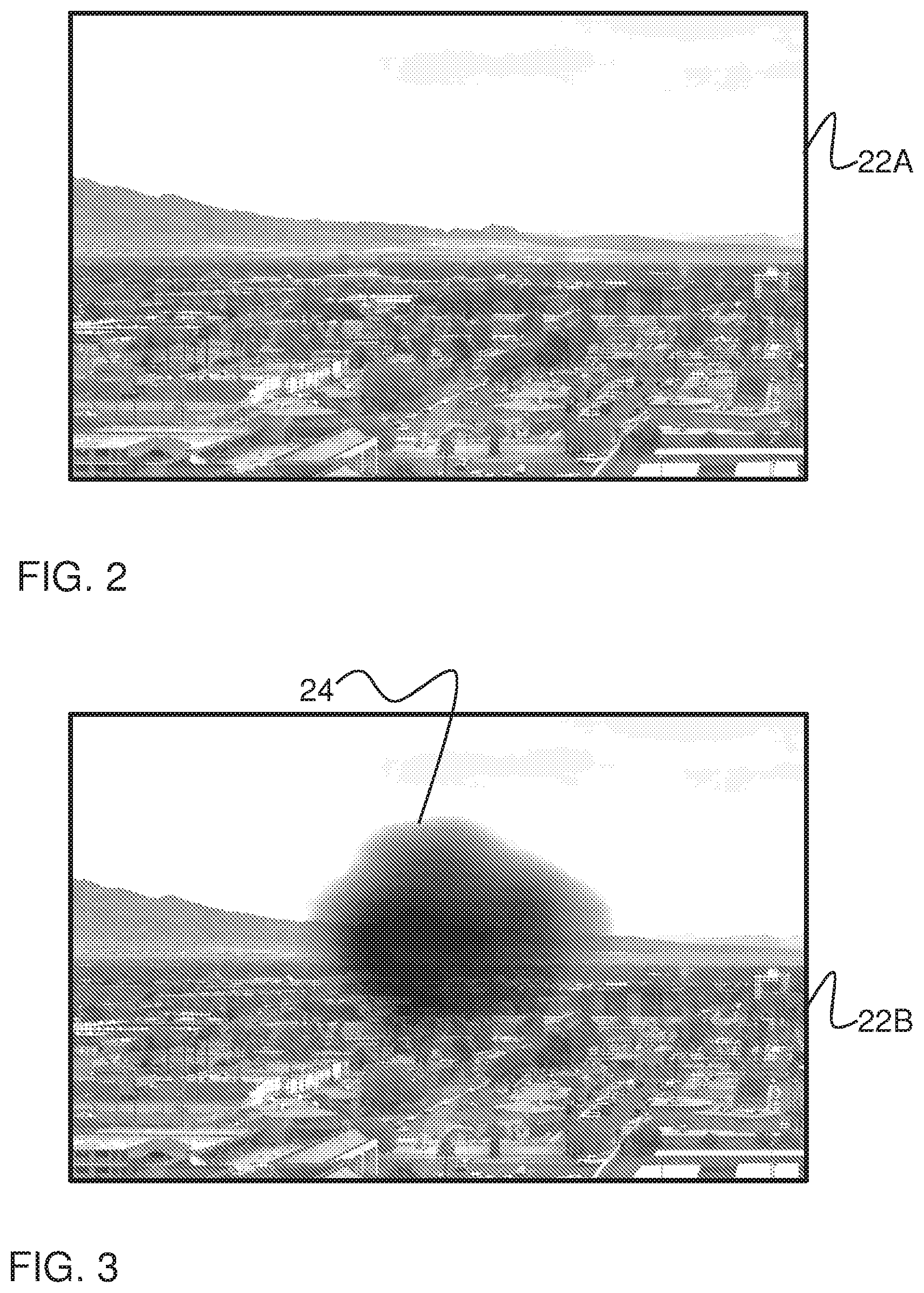 Patent US12137974 Figure 2 – System, method, and non-transitory computer-readable storage media related to correction of vision defects using a visual display